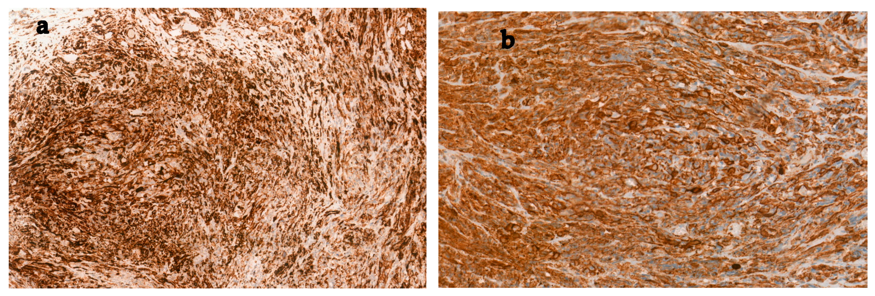 Jcm 14 05999 g003 Jcm 14 05999 g003