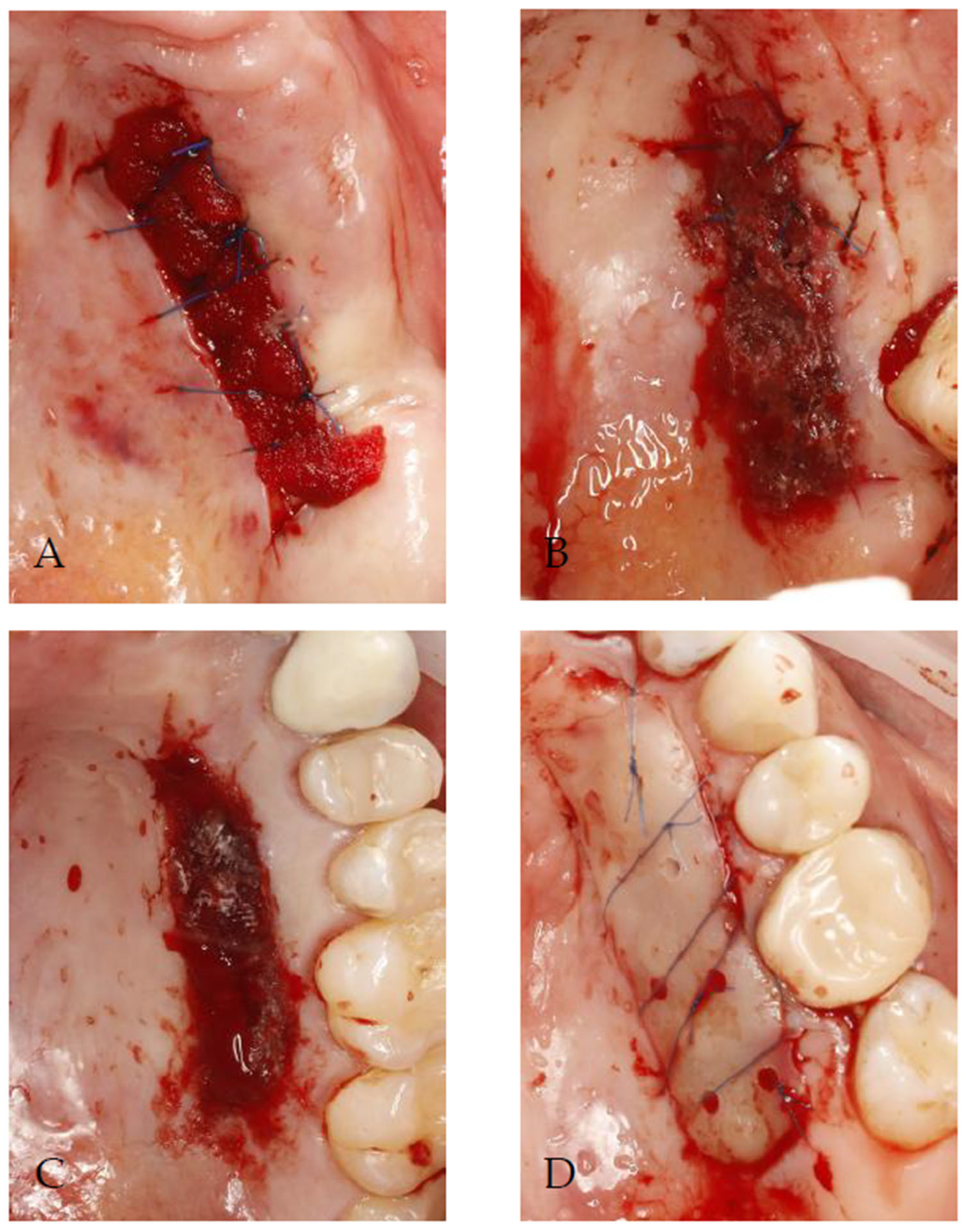 Jcm 14 06009 g001 Jcm 14 06009 g001