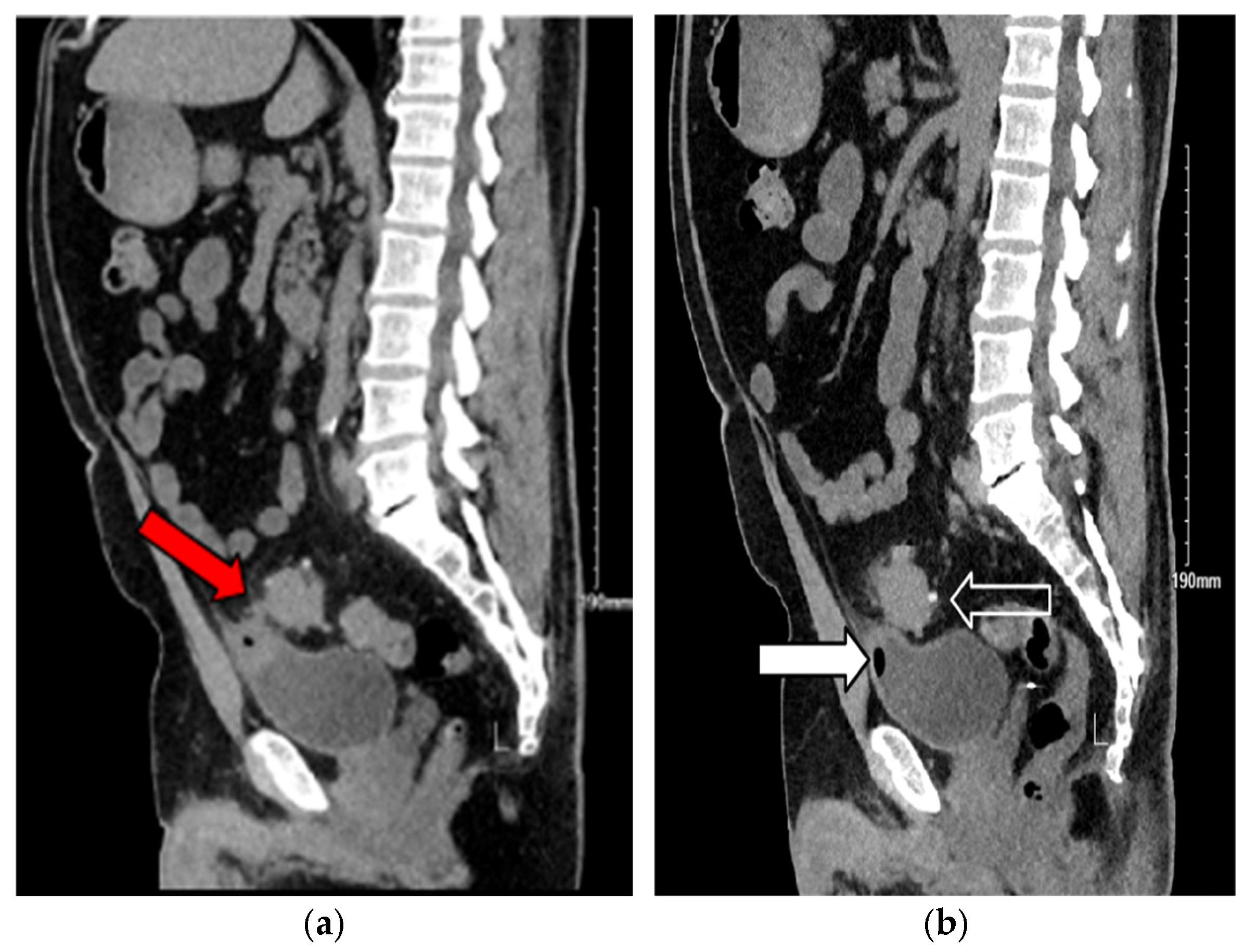 Jcm 14 06065 g003 Jcm 14 06065 g003