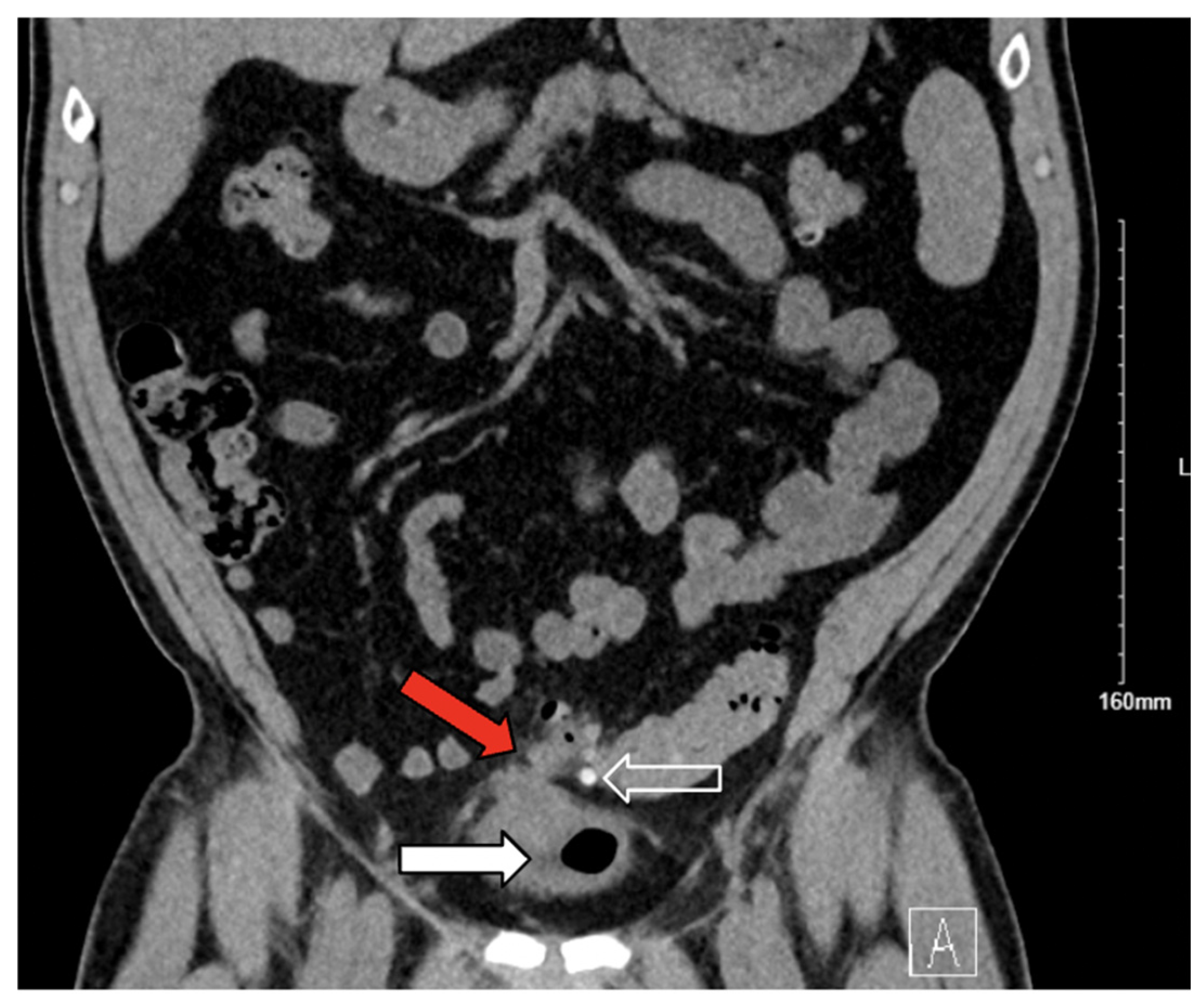 Jcm 14 06065 g004 Jcm 14 06065 g004