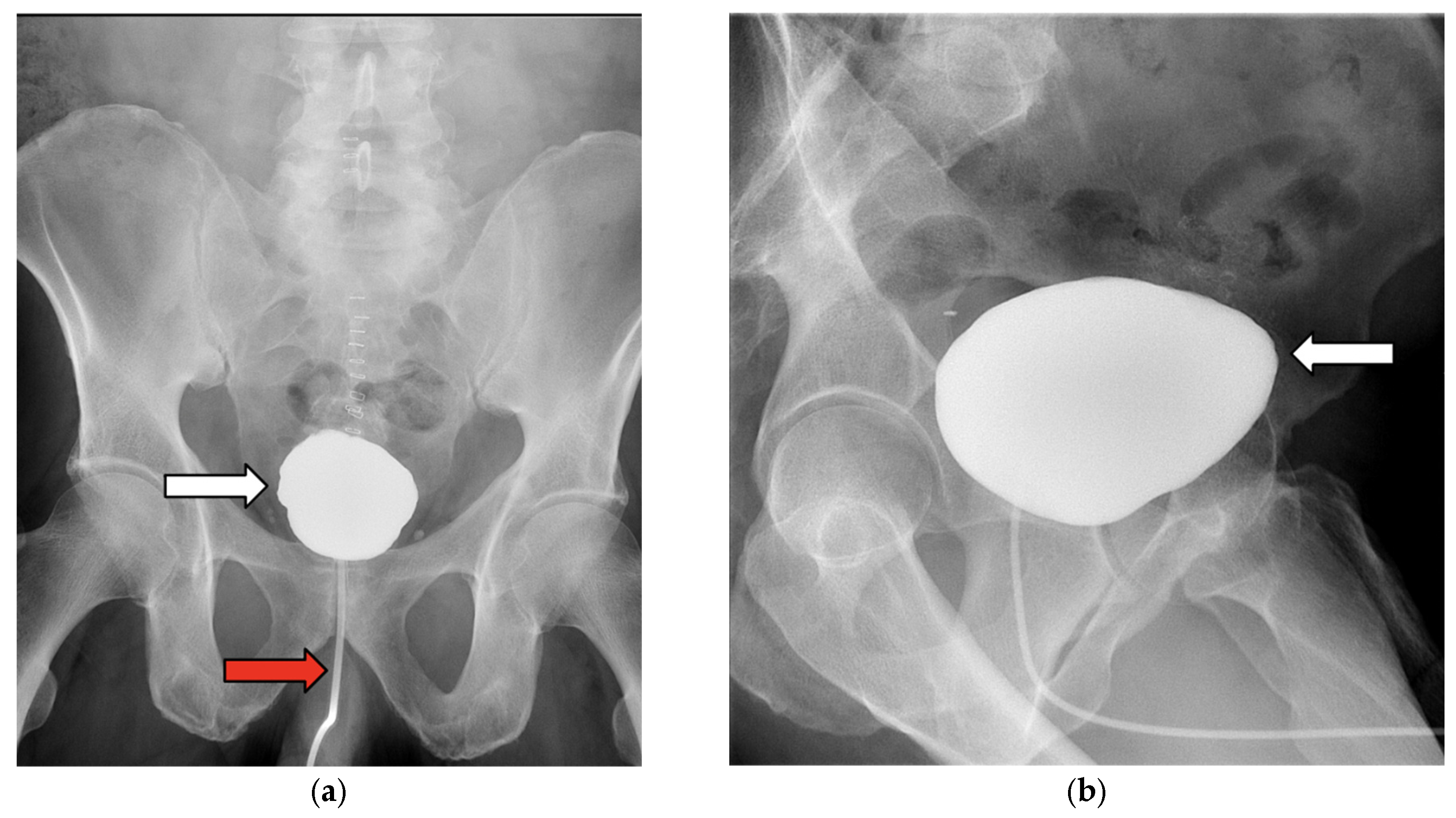 Jcm 14 06065 g006 Jcm 14 06065 g006