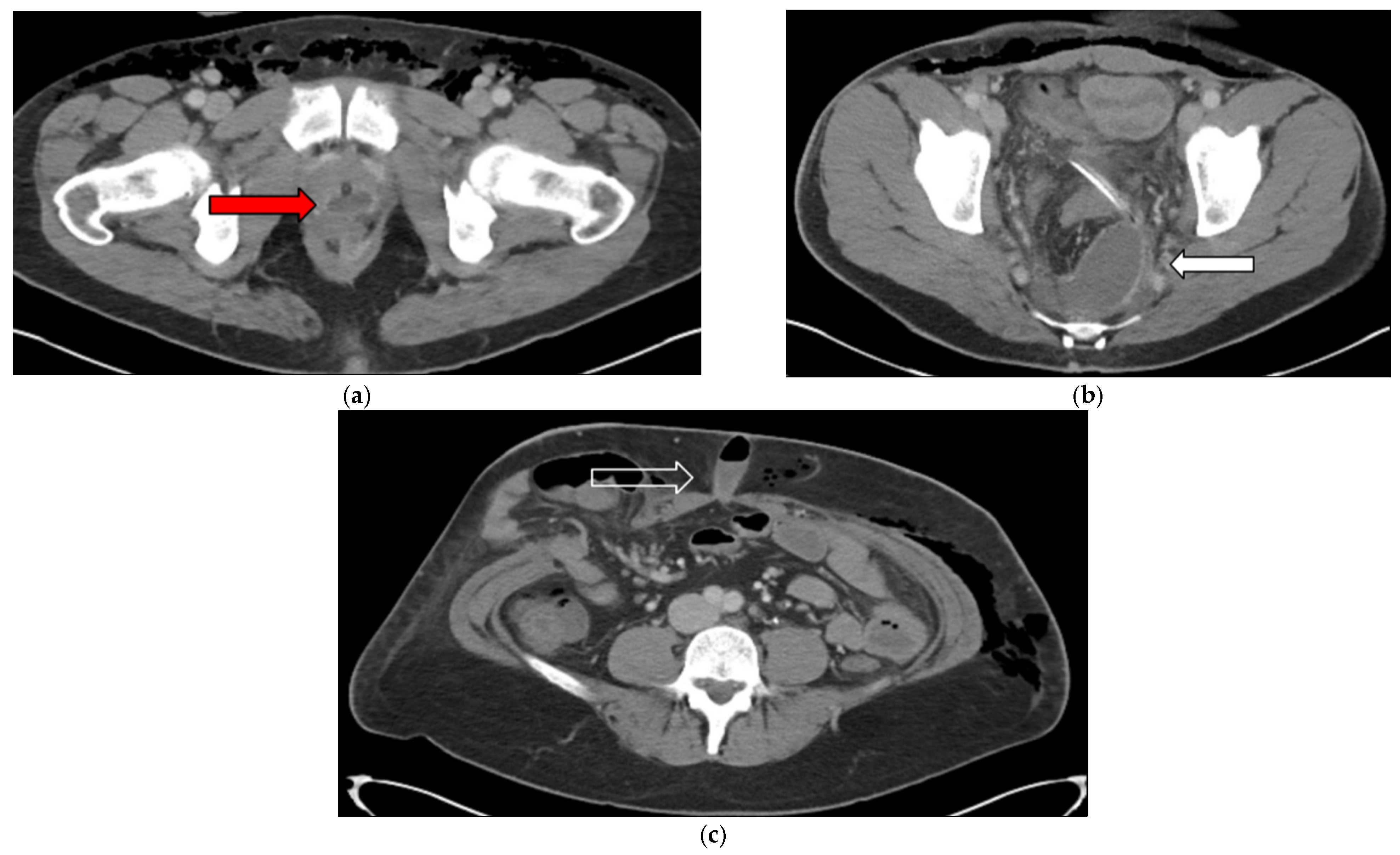 Jcm 14 06065 g008 Jcm 14 06065 g008