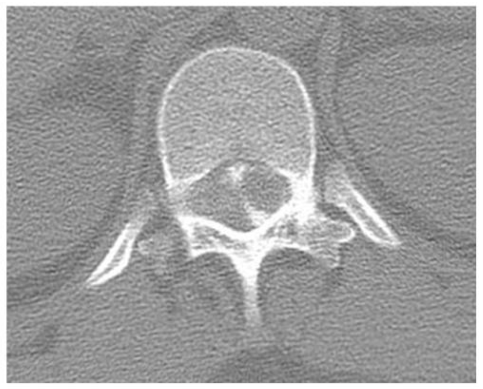 Jcm 14 06068 g001 Jcm 14 06068 g001