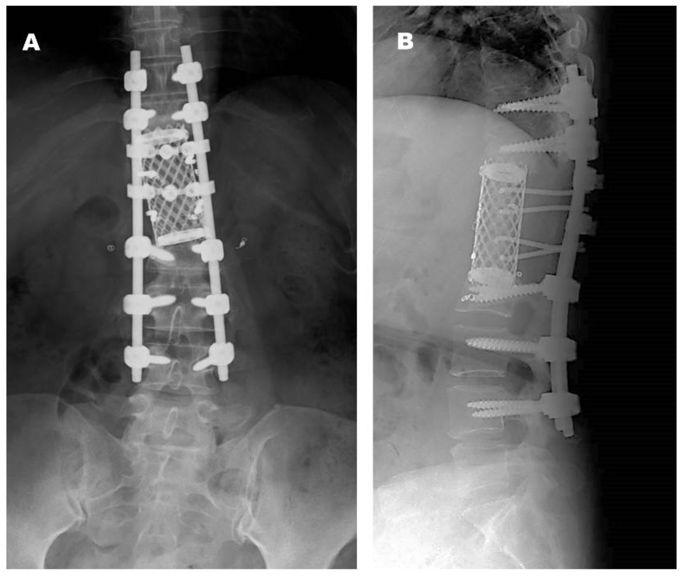 Jcm 14 06068 g004 Jcm 14 06068 g004