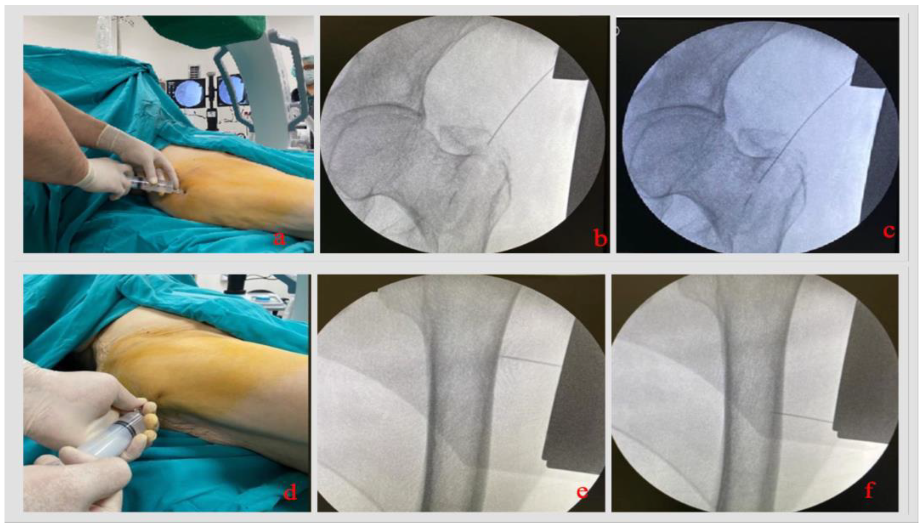 Jcm 14 06078 g001 Jcm 14 06078 g001