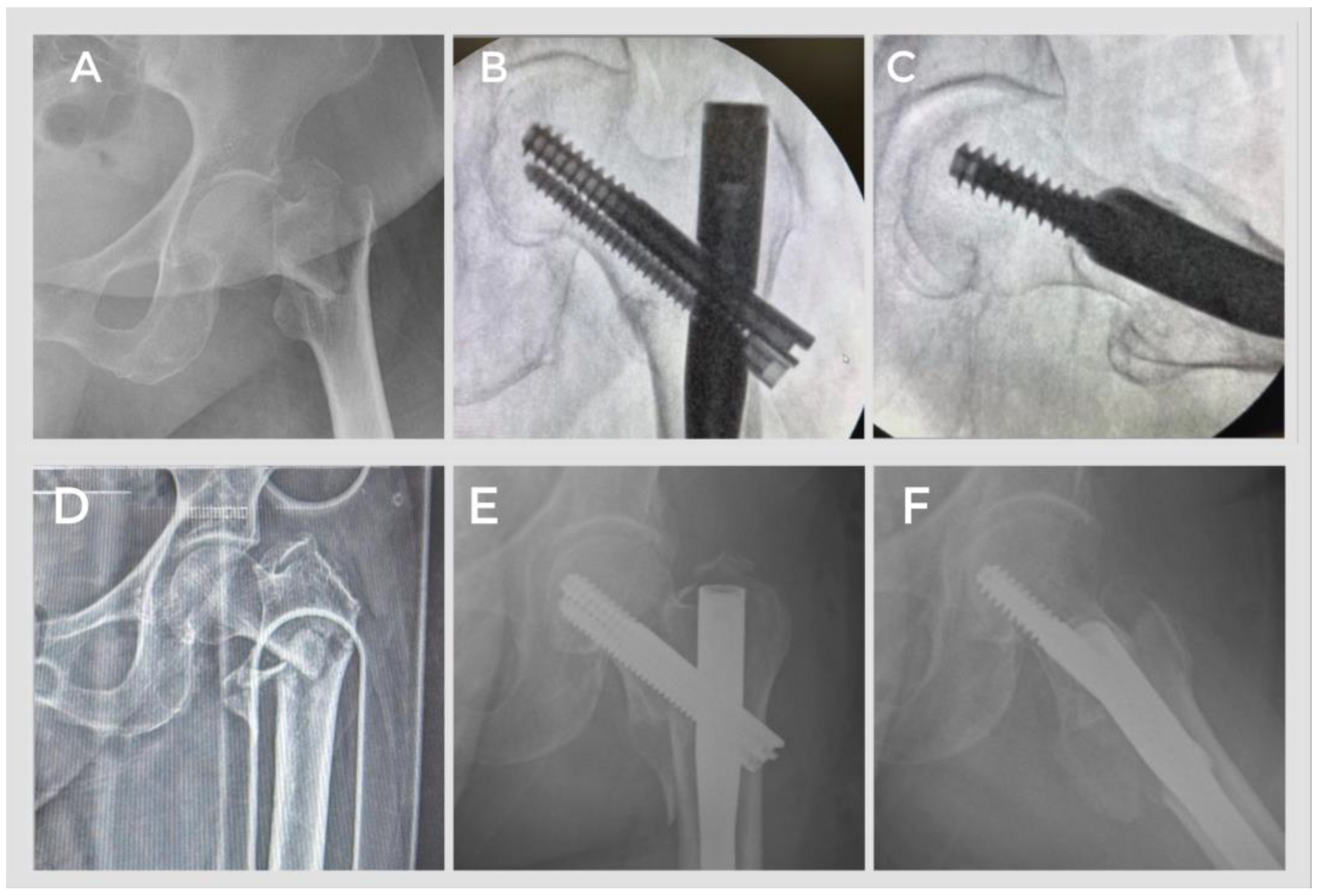 Jcm 14 06078 g003 Jcm 14 06078 g003