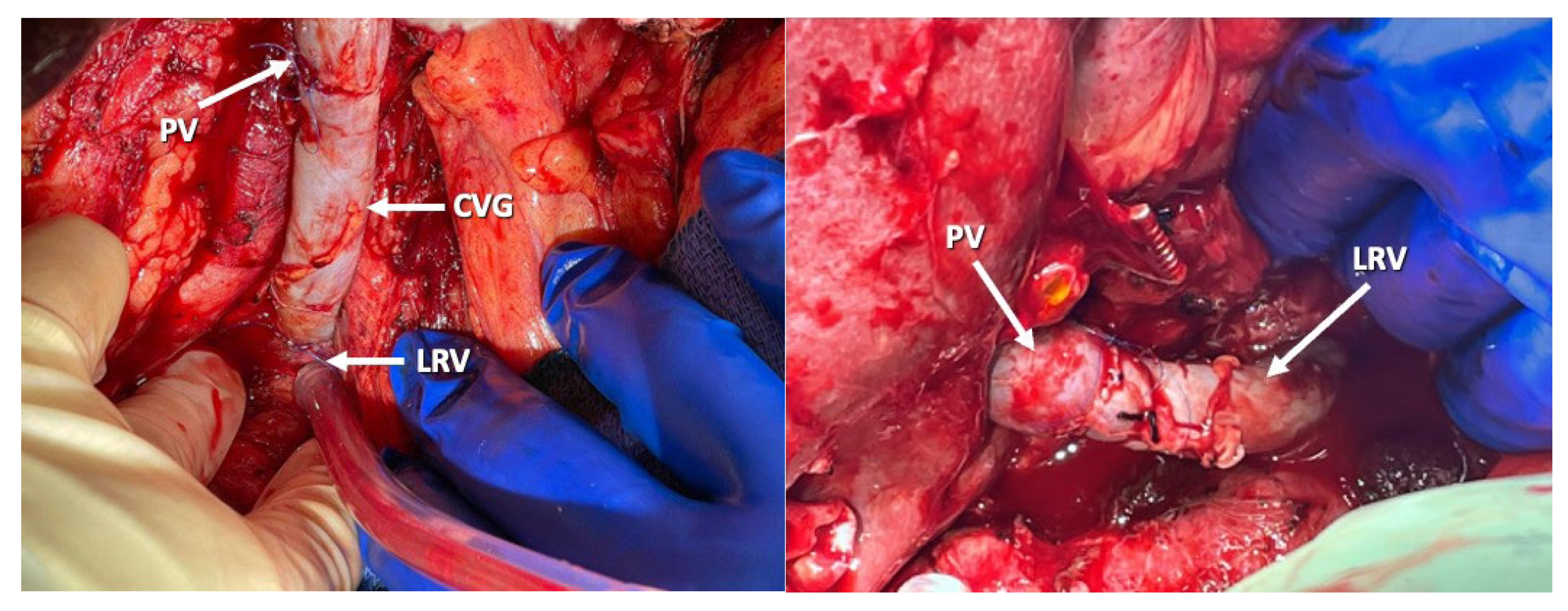 Jcm 14 06100 g005 Jcm 14 06100 g005