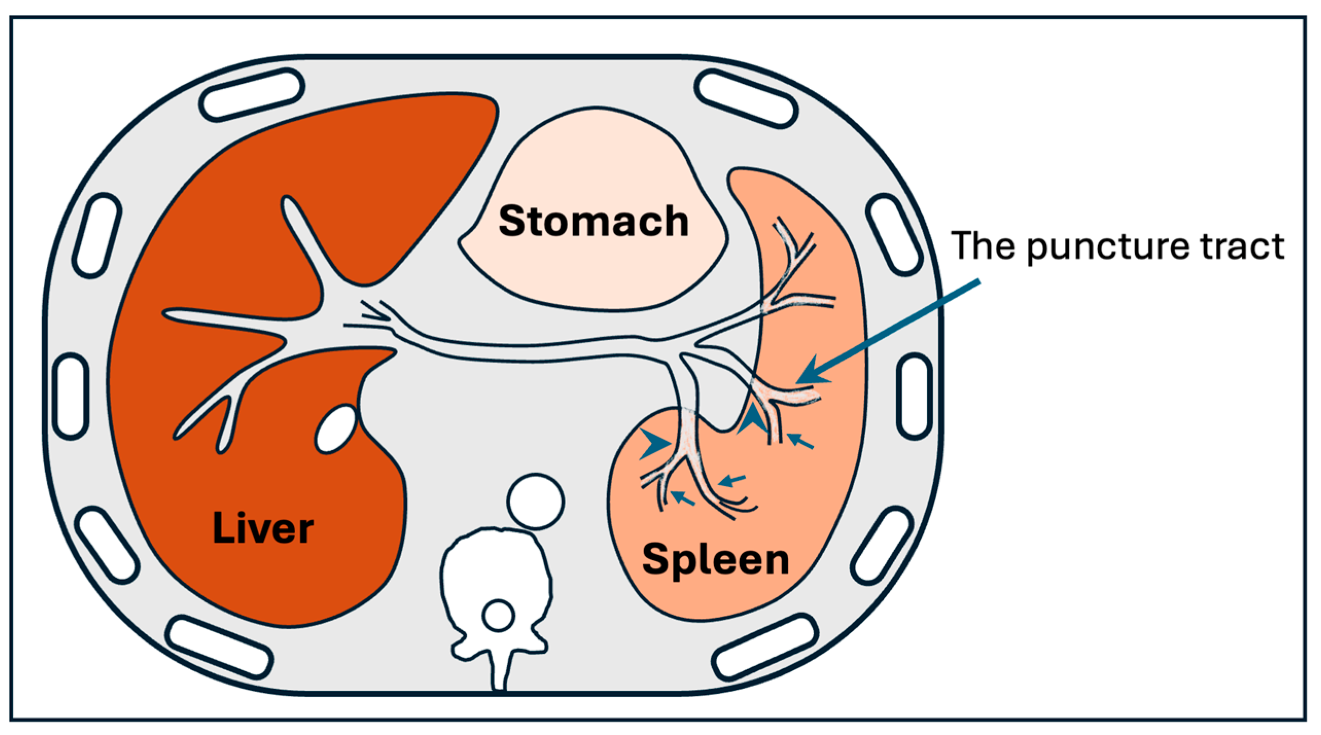 Jcm 14 06100 g007 Jcm 14 06100 g007