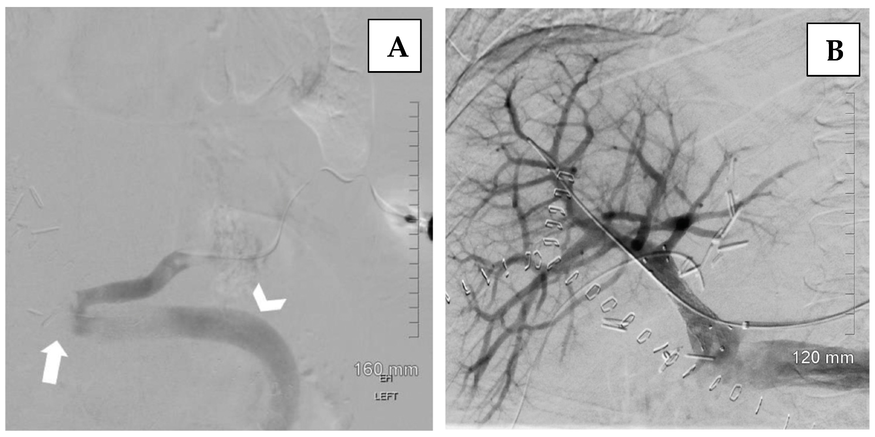 Jcm 14 06100 g008 Jcm 14 06100 g008
