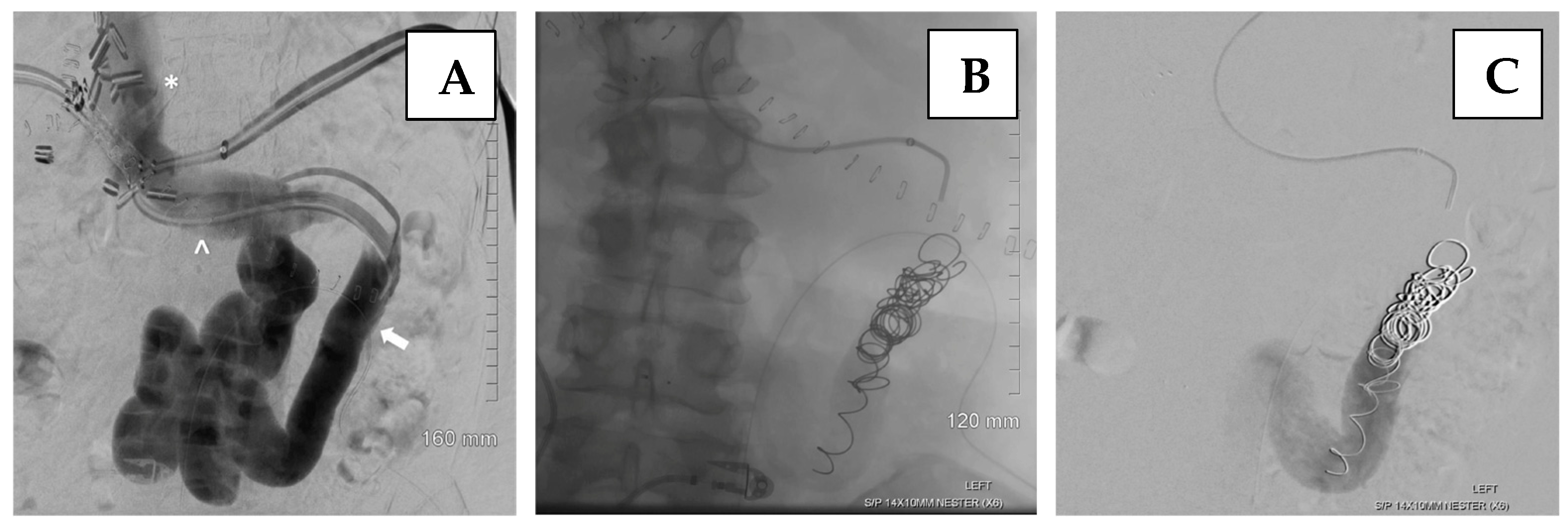Jcm 14 06100 g009 Jcm 14 06100 g009