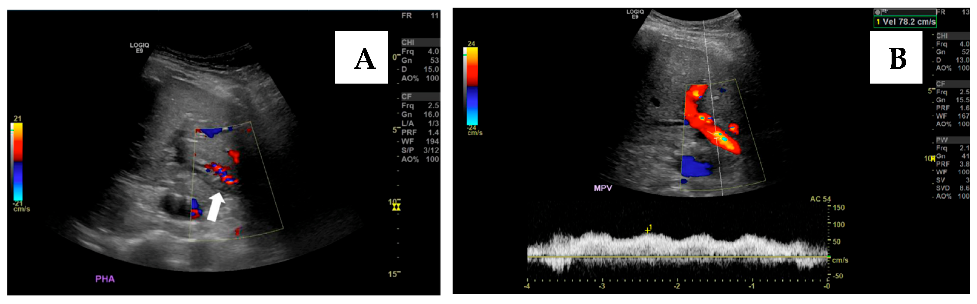 Jcm 14 06100 g010 Jcm 14 06100 g010