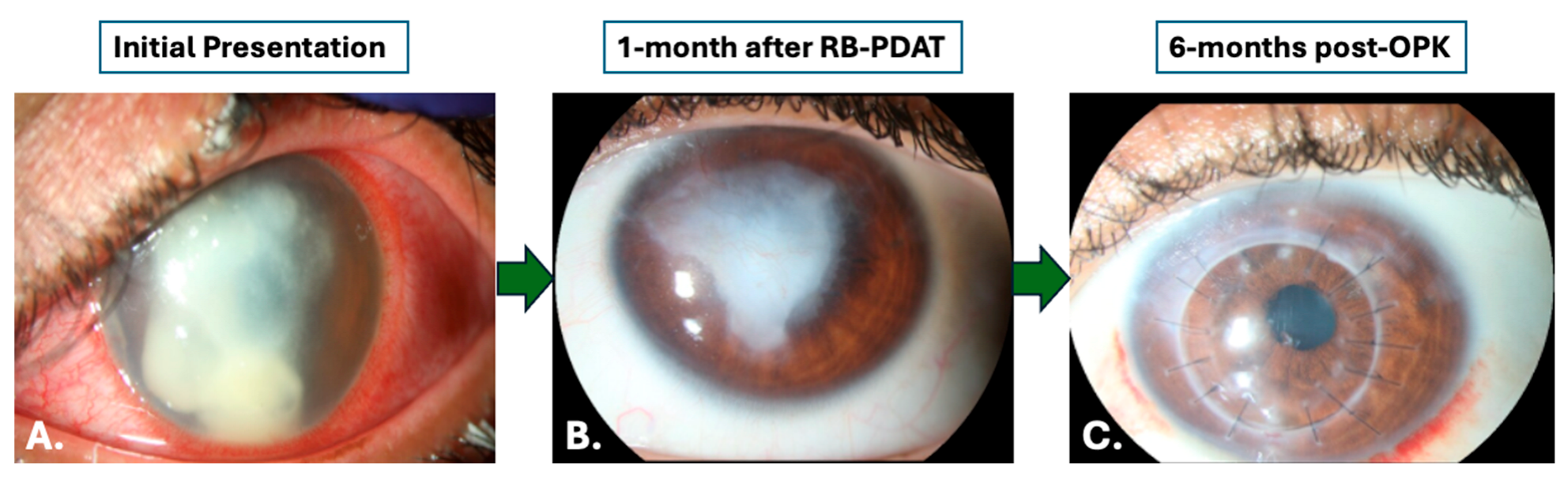 Jcm 14 06104 g001 Jcm 14 06104 g001