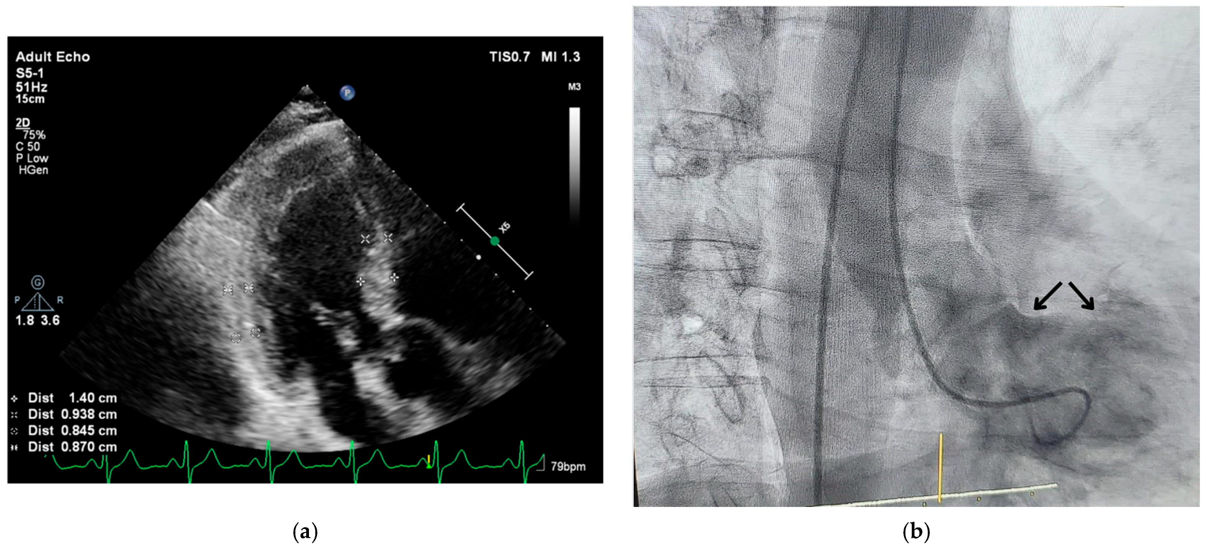 Jcm 14 06143 g002 Jcm 14 06143 g002