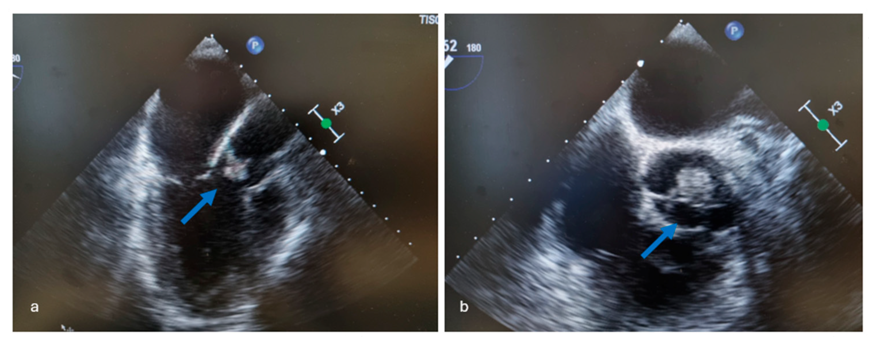 Jcm 14 06149 g002 Jcm 14 06149 g002