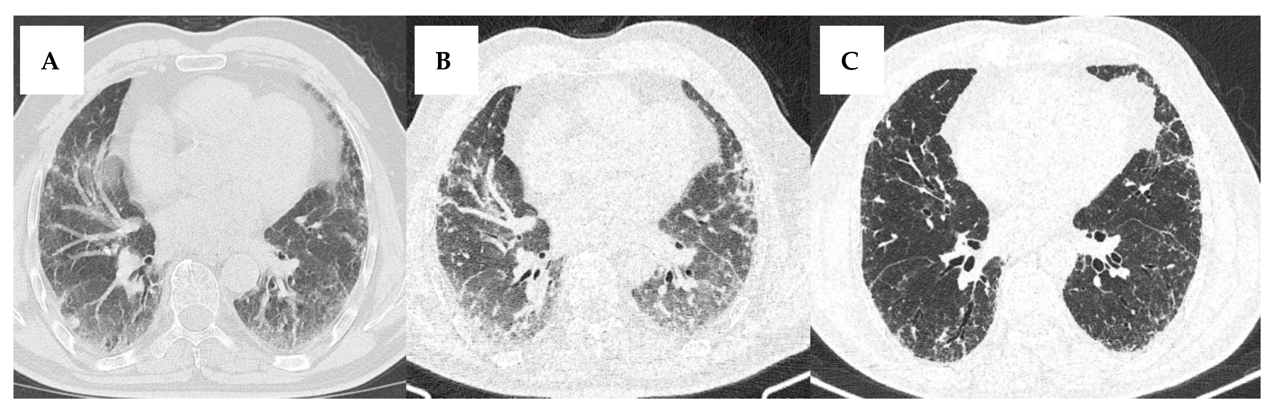 Jcm 14 06164 g005 Jcm 14 06164 g005
