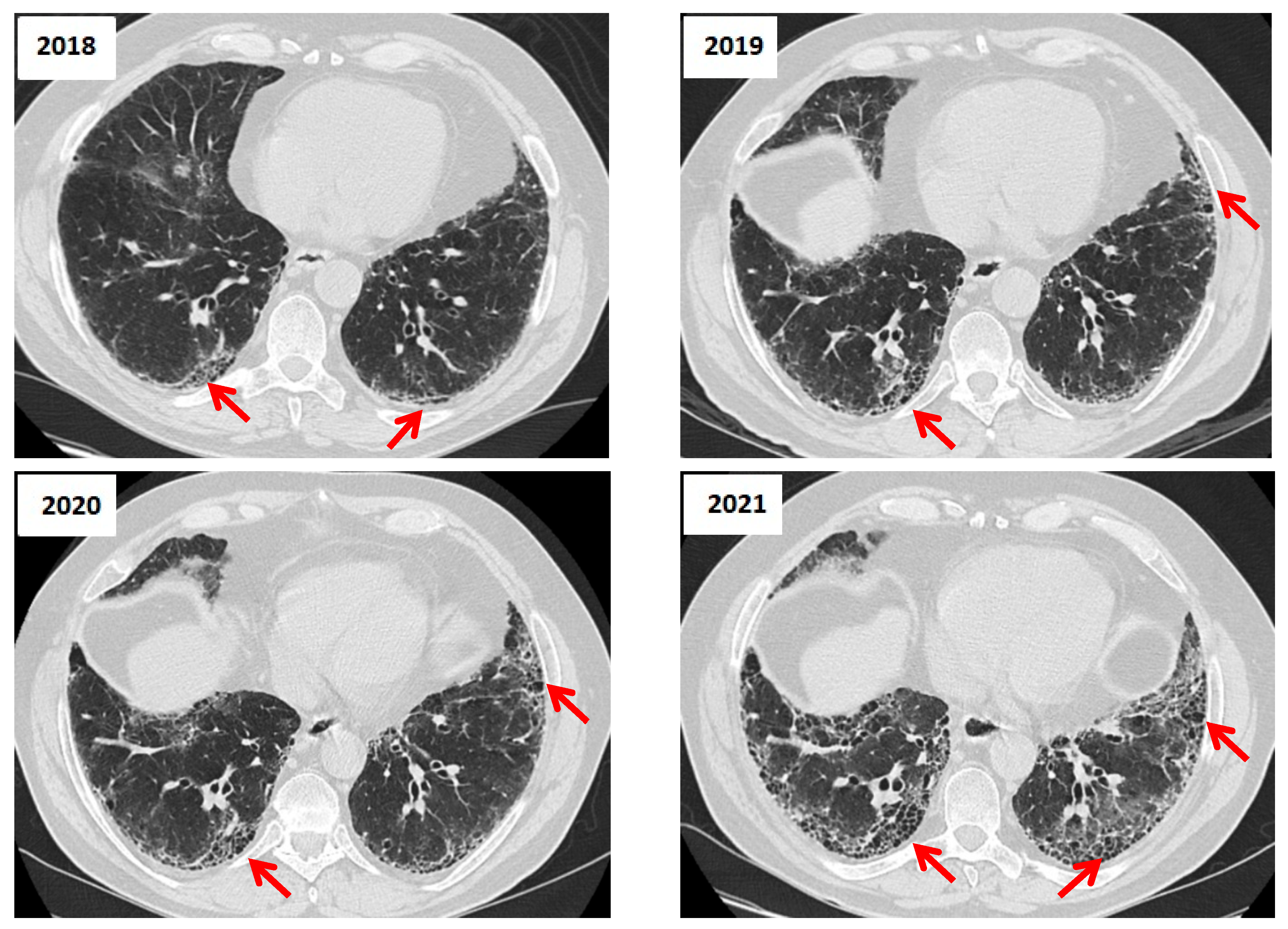 Jcm 14 06164 g006 Jcm 14 06164 g006