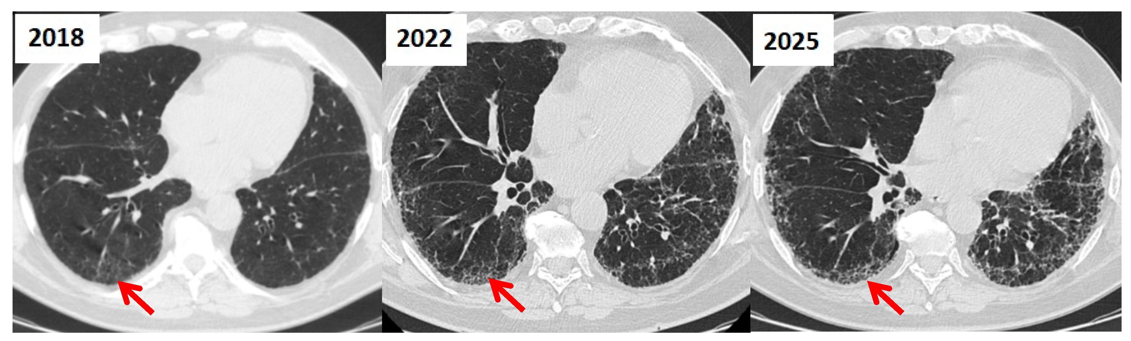 Jcm 14 06164 g007 Jcm 14 06164 g007
