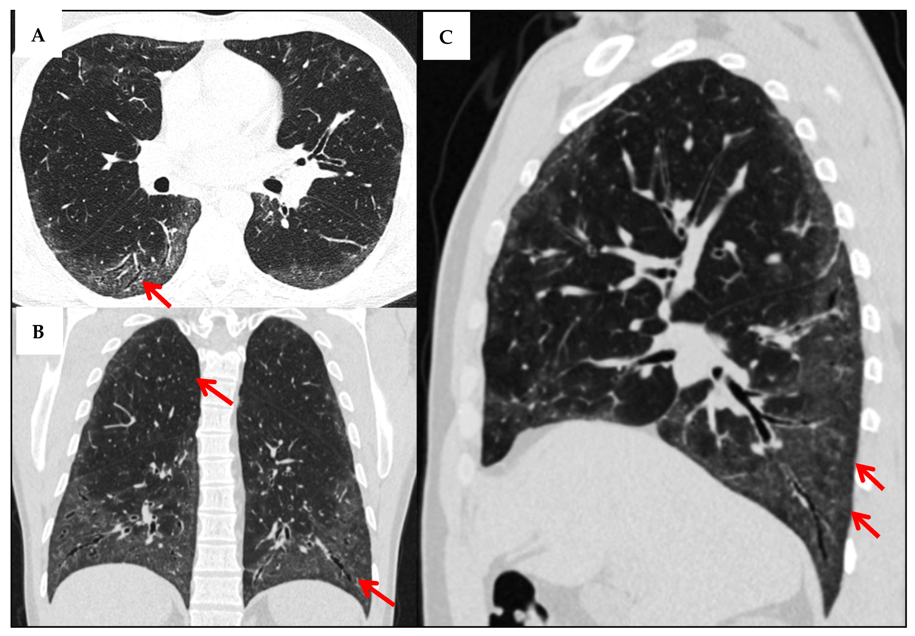 Jcm 14 06164 g008 Jcm 14 06164 g008