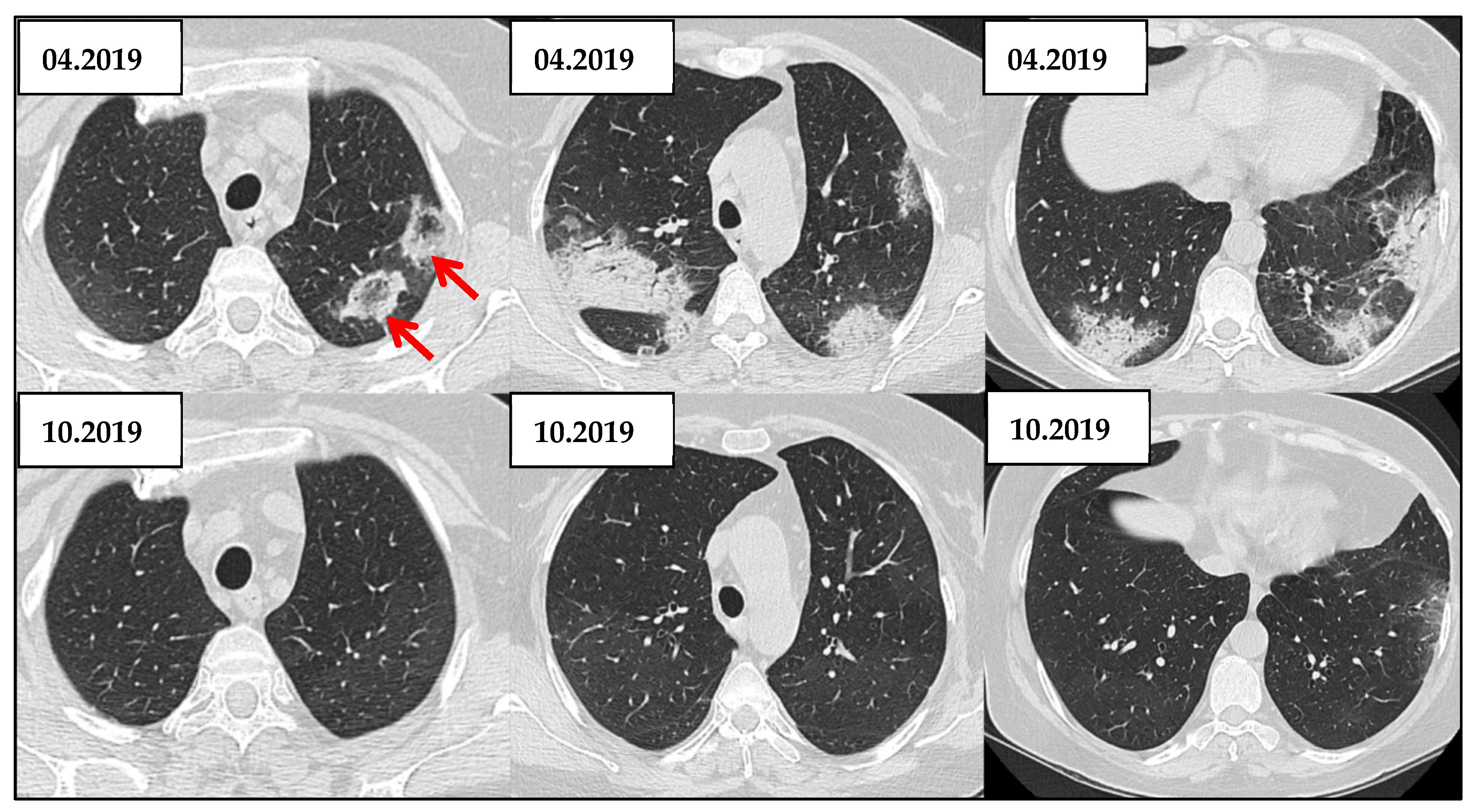 Jcm 14 06164 g009 Jcm 14 06164 g009