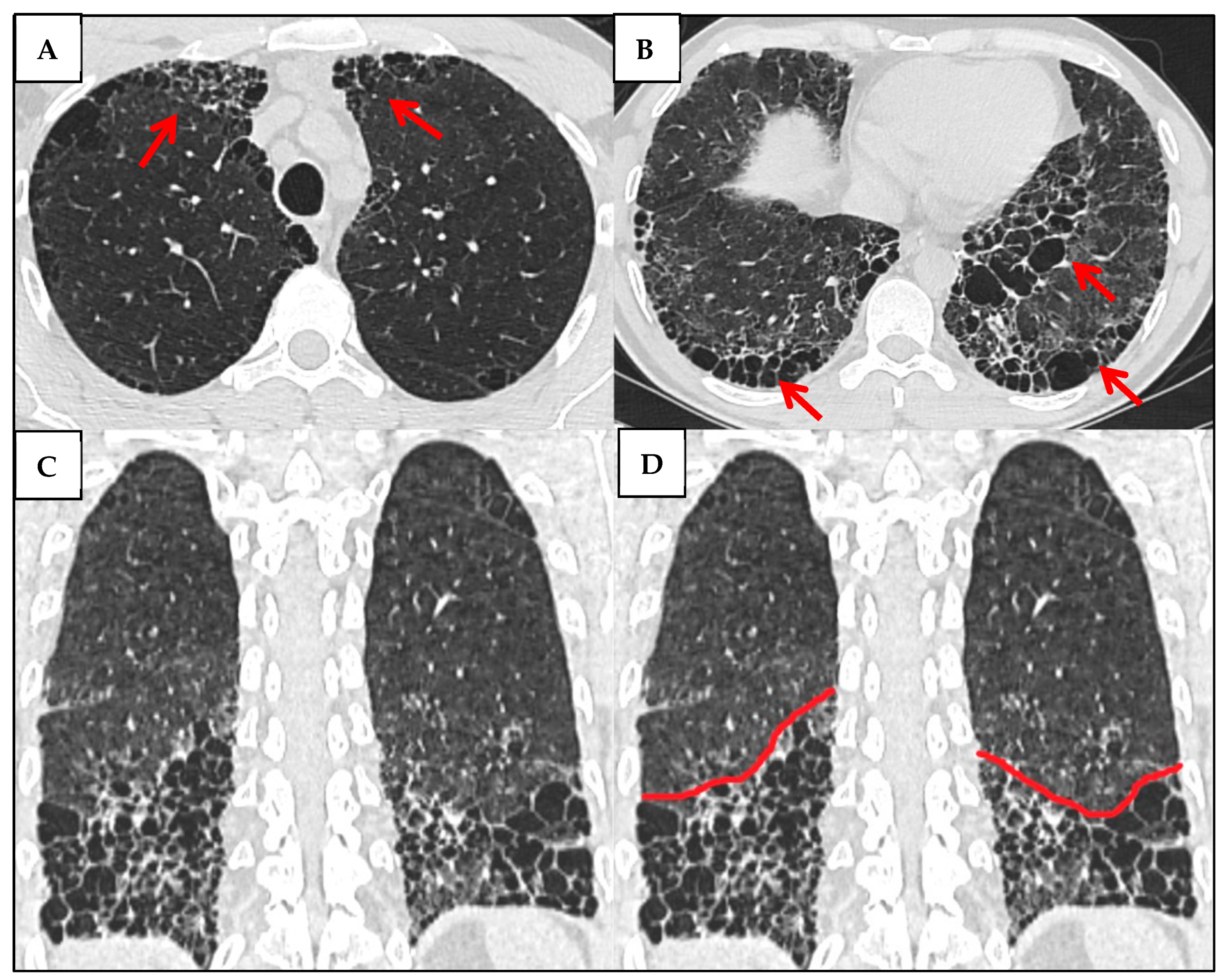 Jcm 14 06164 g012 Jcm 14 06164 g012