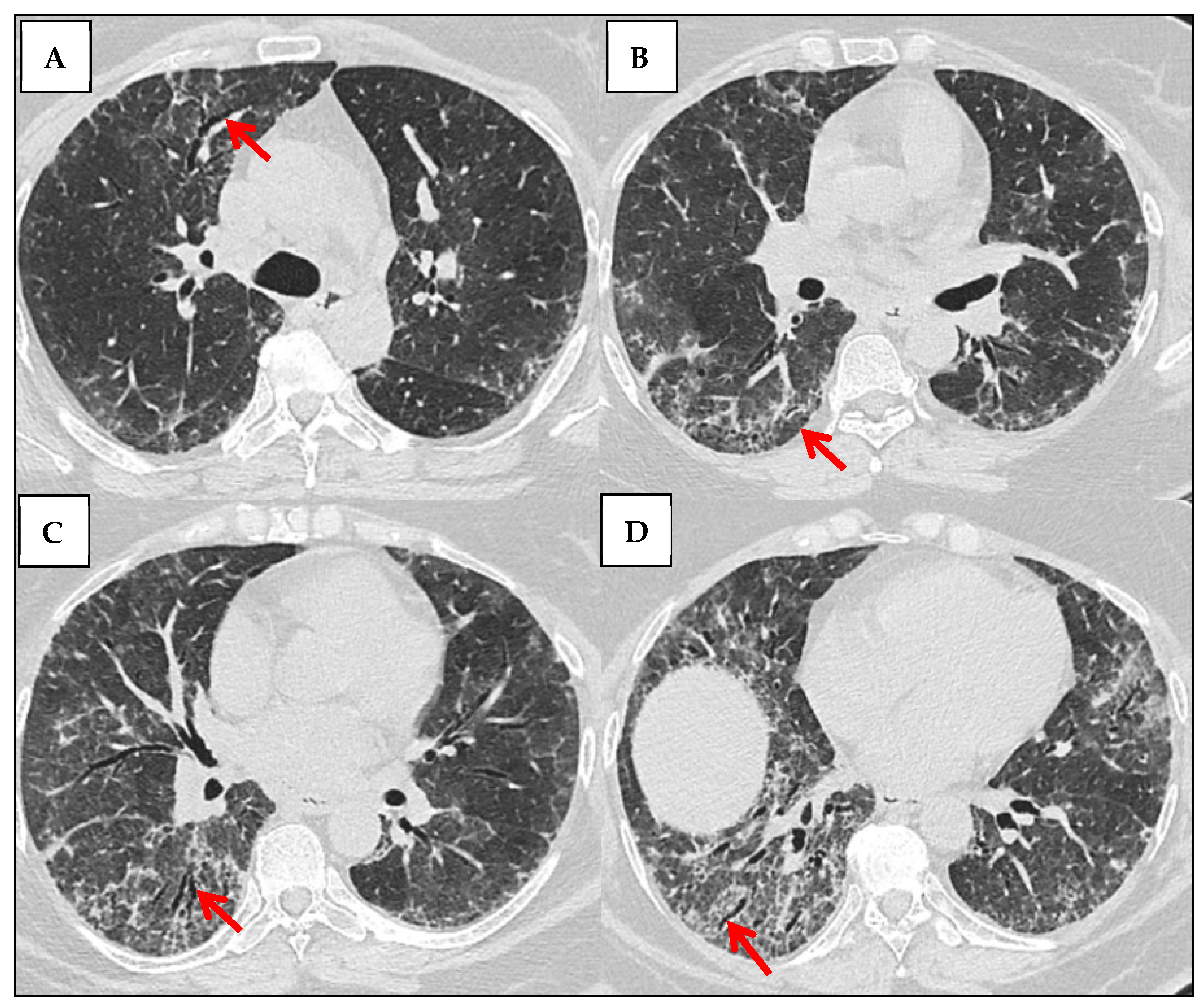 Jcm 14 06164 g013 Jcm 14 06164 g013