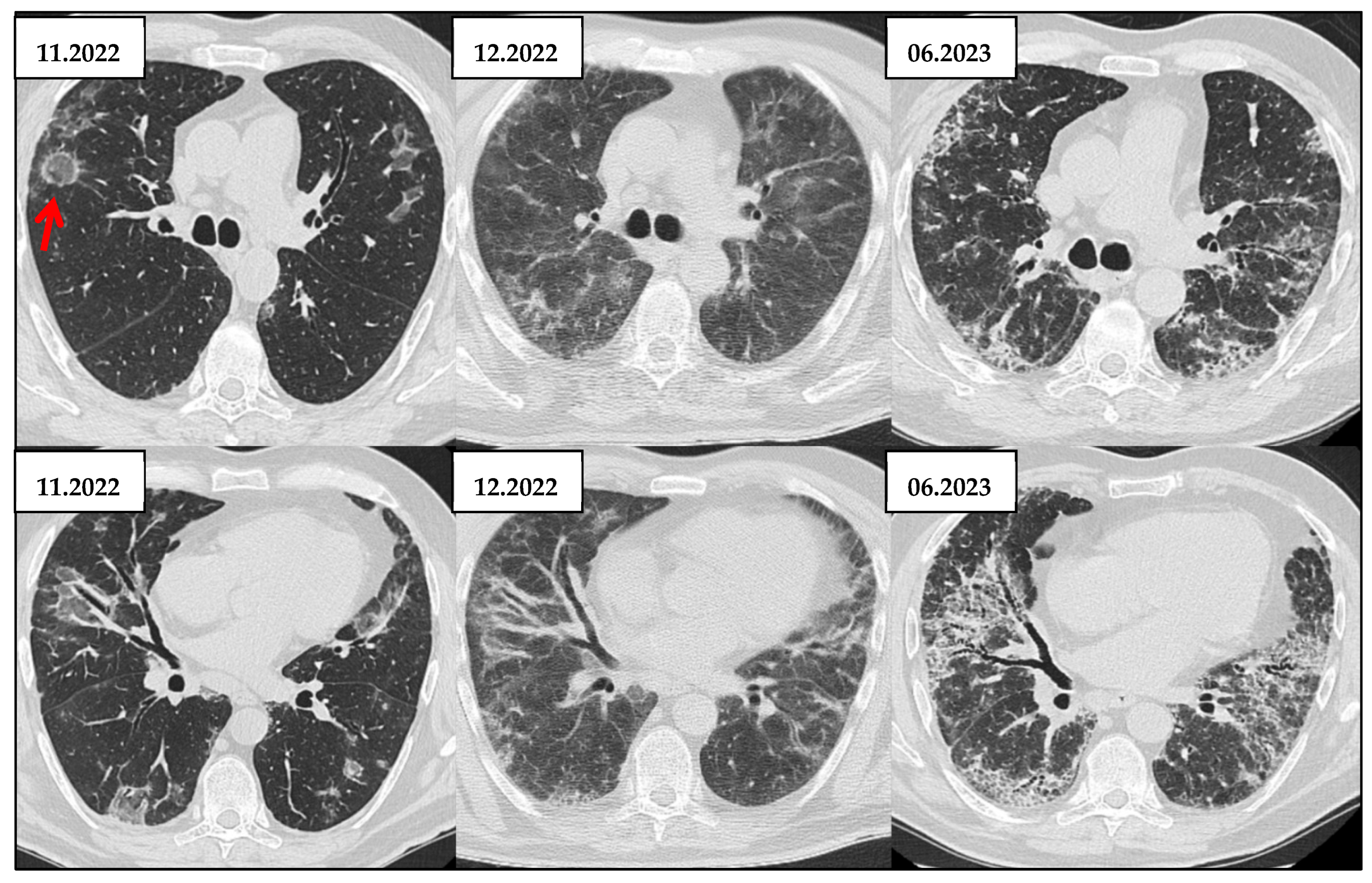 Jcm 14 06164 g014 Jcm 14 06164 g014
