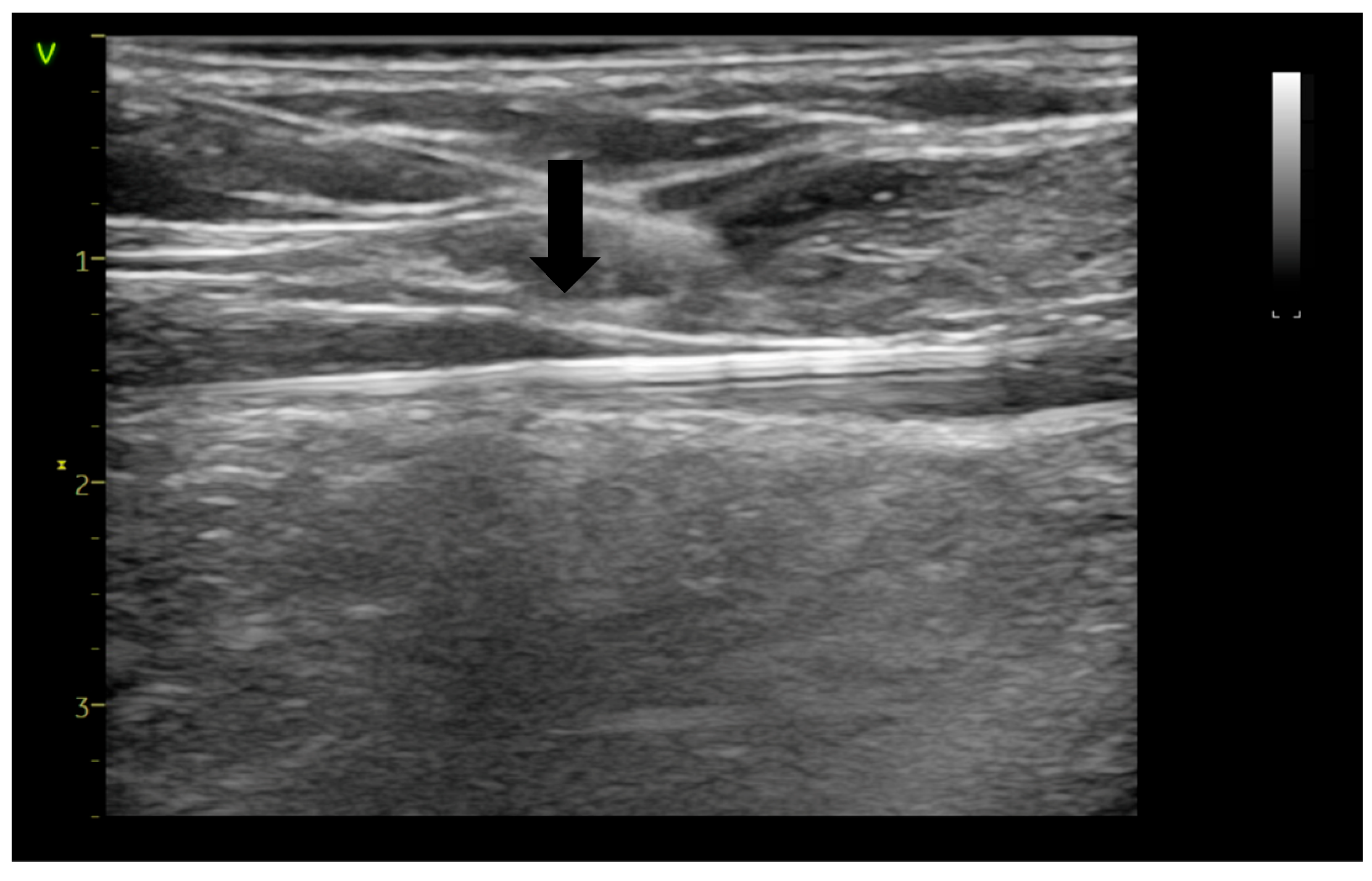 Jcm 14 06165 g002 Jcm 14 06165 g002