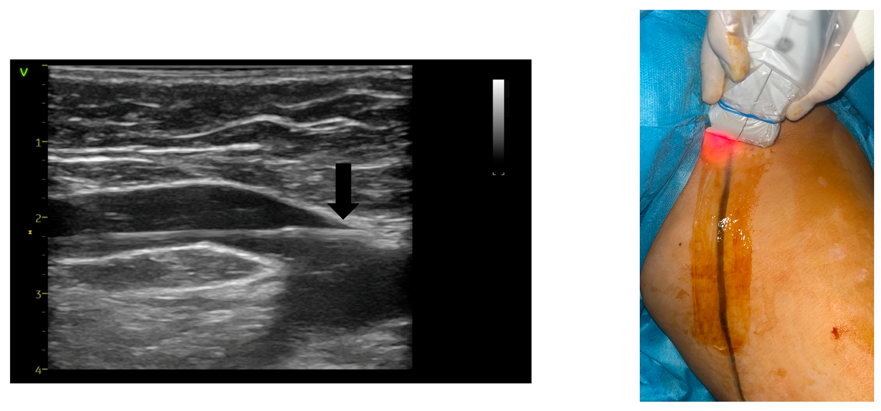 Jcm 14 06165 g003 Jcm 14 06165 g003