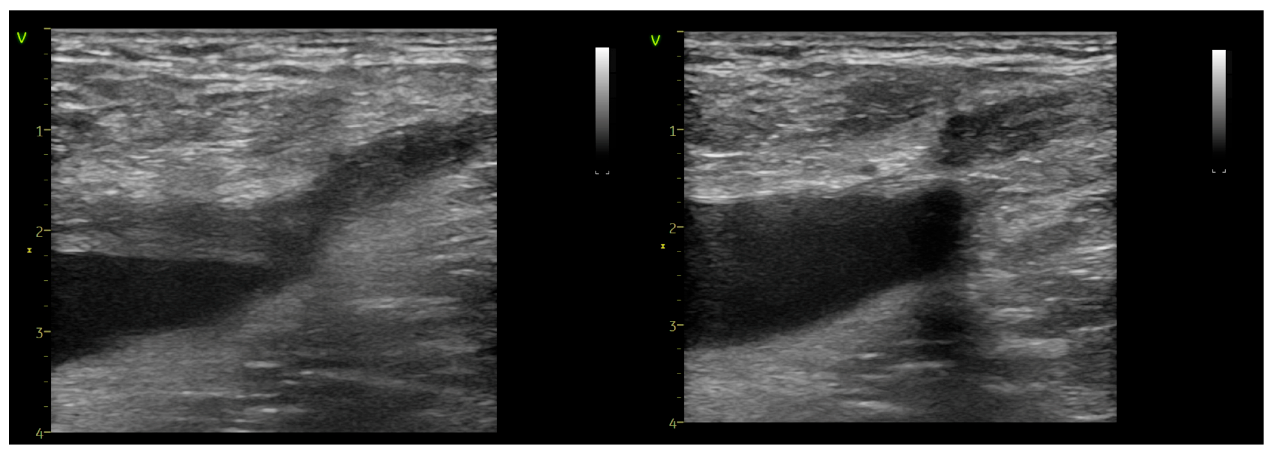 Jcm 14 06165 g004 Jcm 14 06165 g004