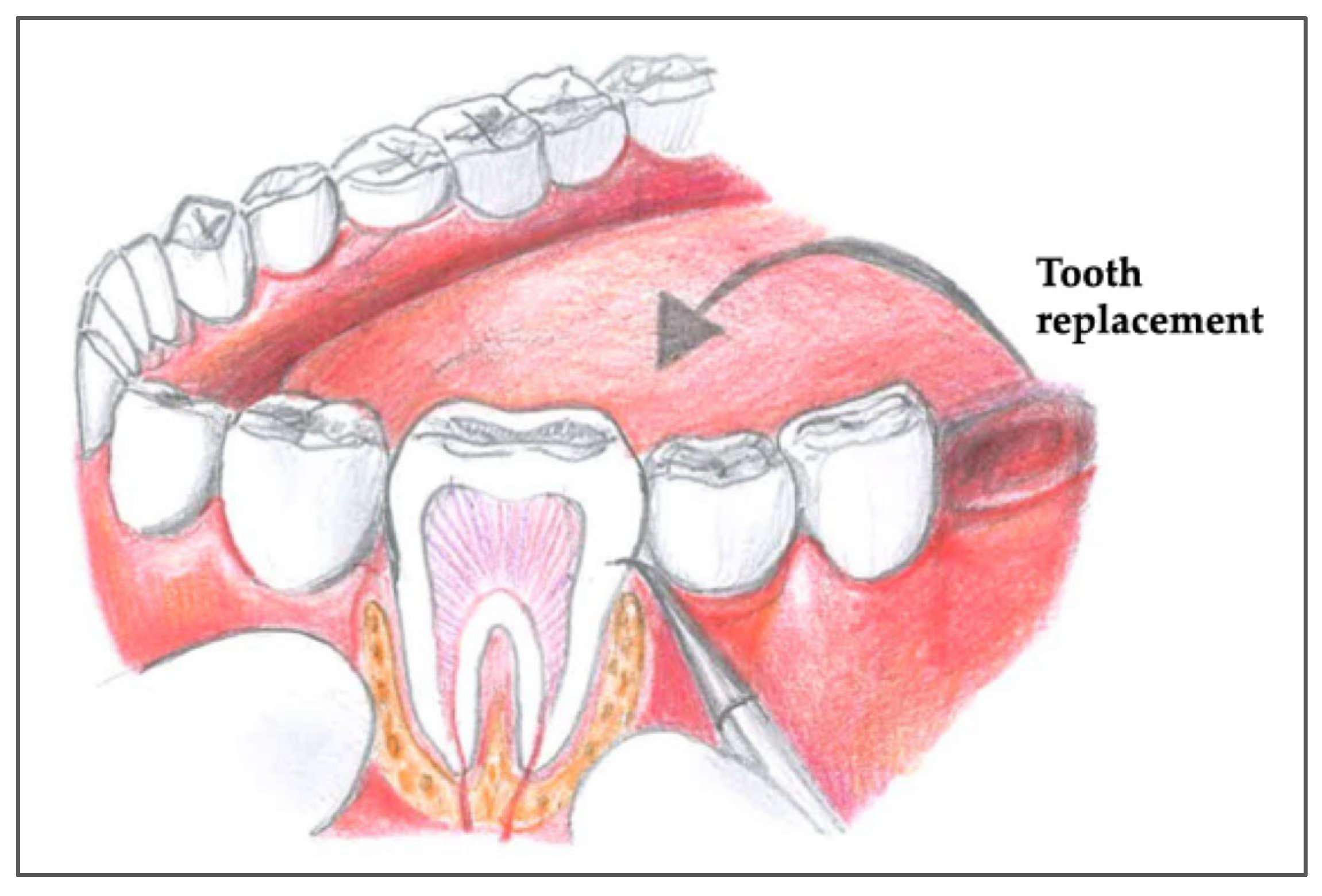 Jcm 14 06249 g001 Jcm 14 06249 g001