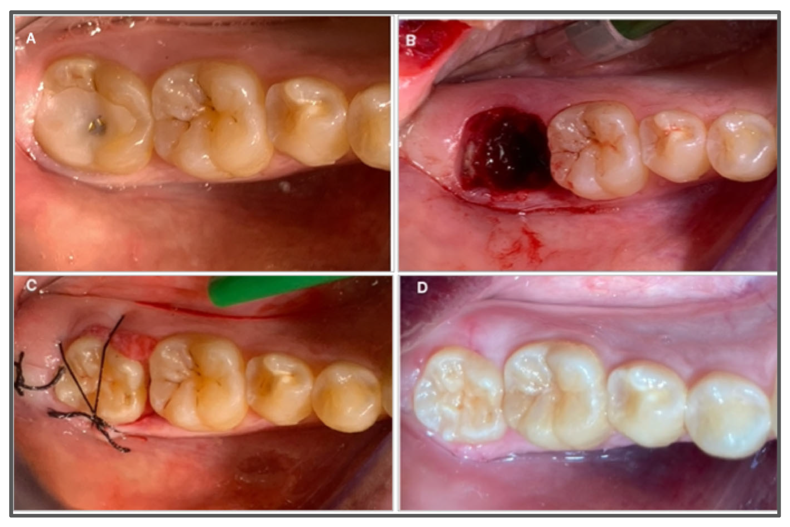 Jcm 14 06249 g004 Jcm 14 06249 g004