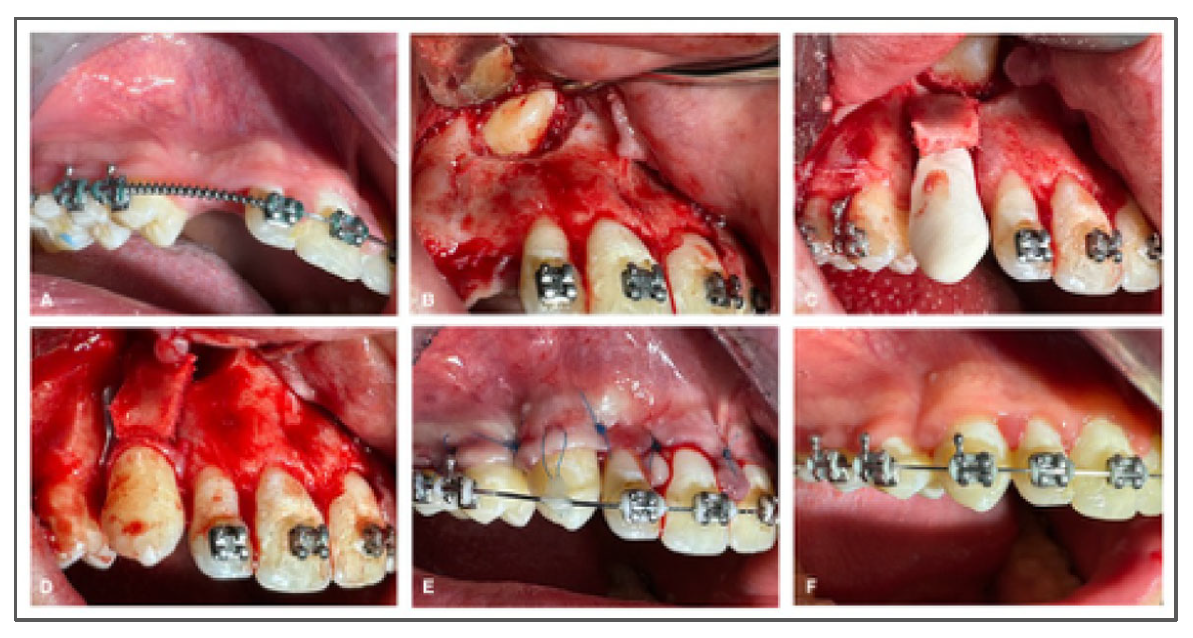 Jcm 14 06249 g005a Jcm 14 06249 g005a