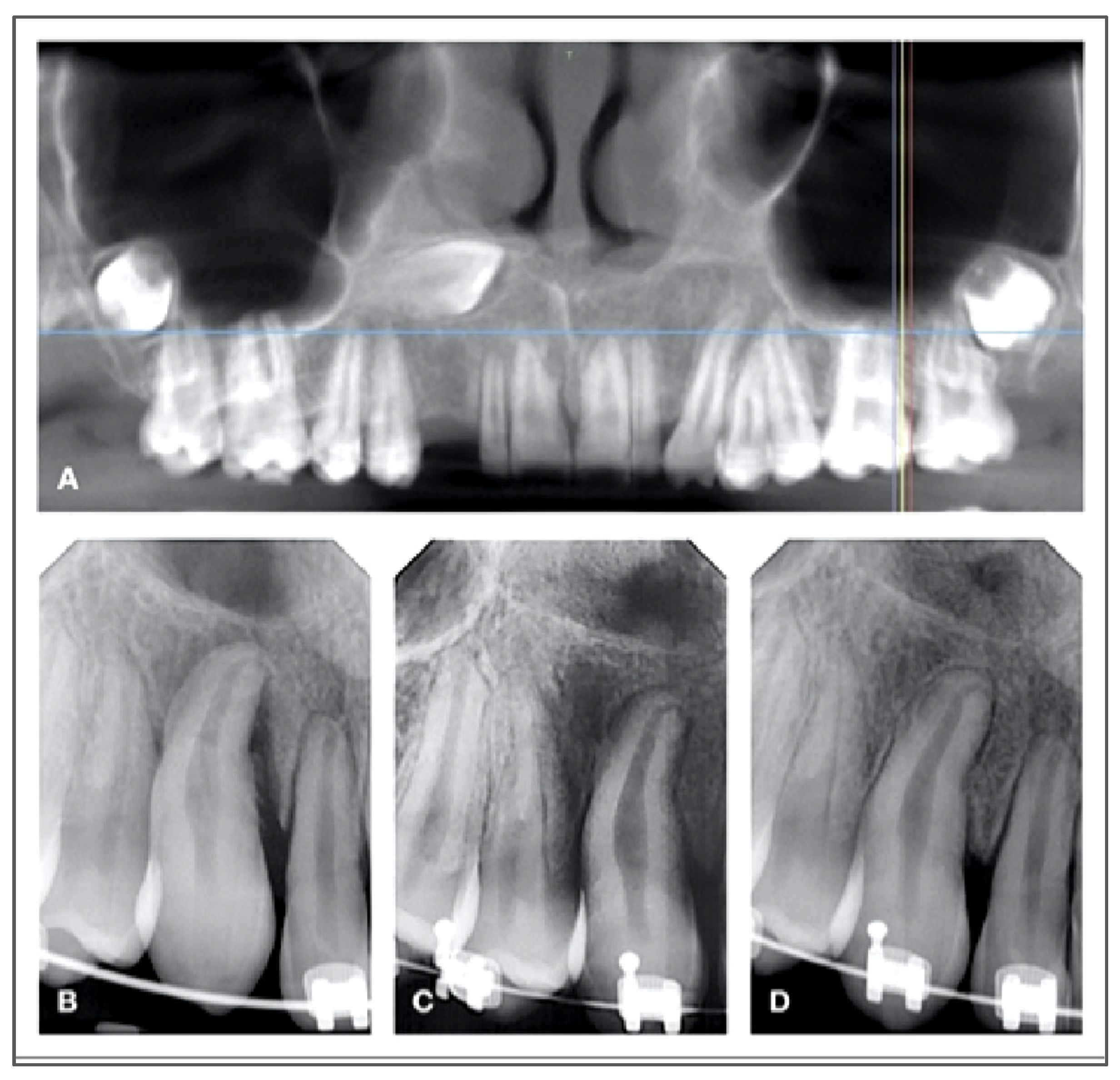 Jcm 14 06249 g005b Jcm 14 06249 g005b