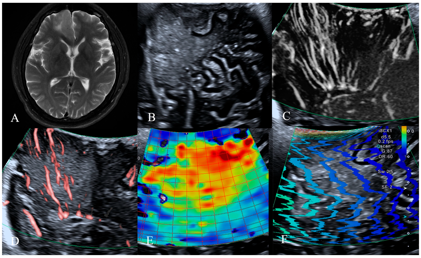 Jcm 14 06264 g001 Jcm 14 06264 g001