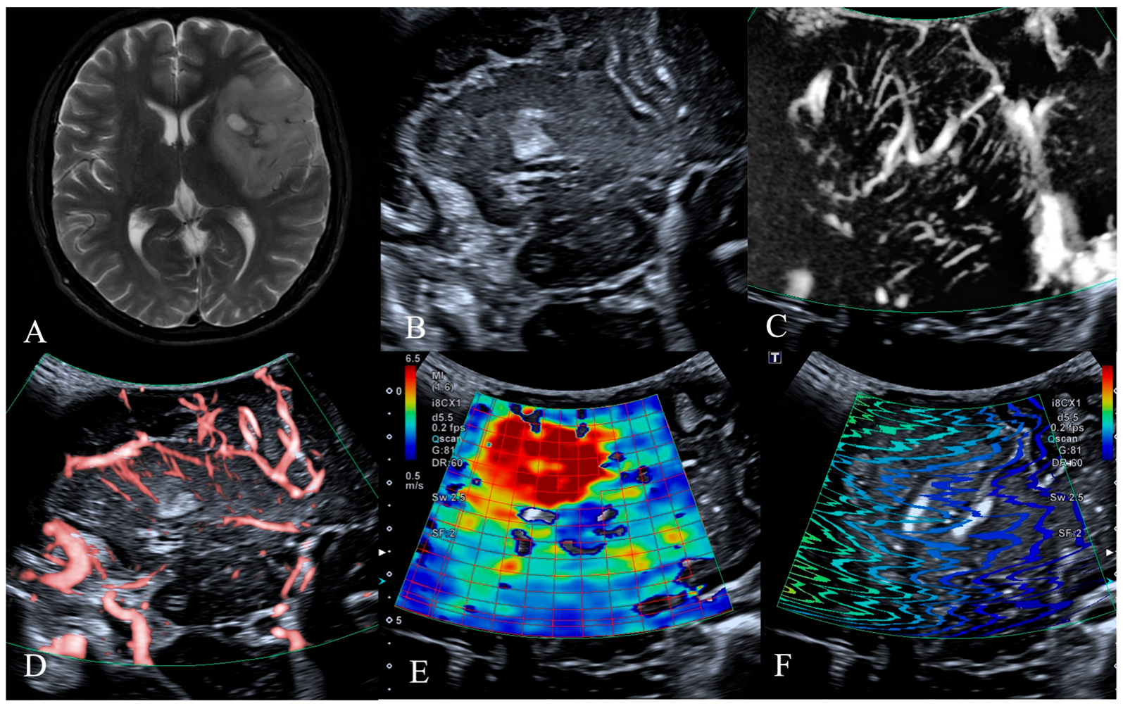 Jcm 14 06264 g002 Jcm 14 06264 g002