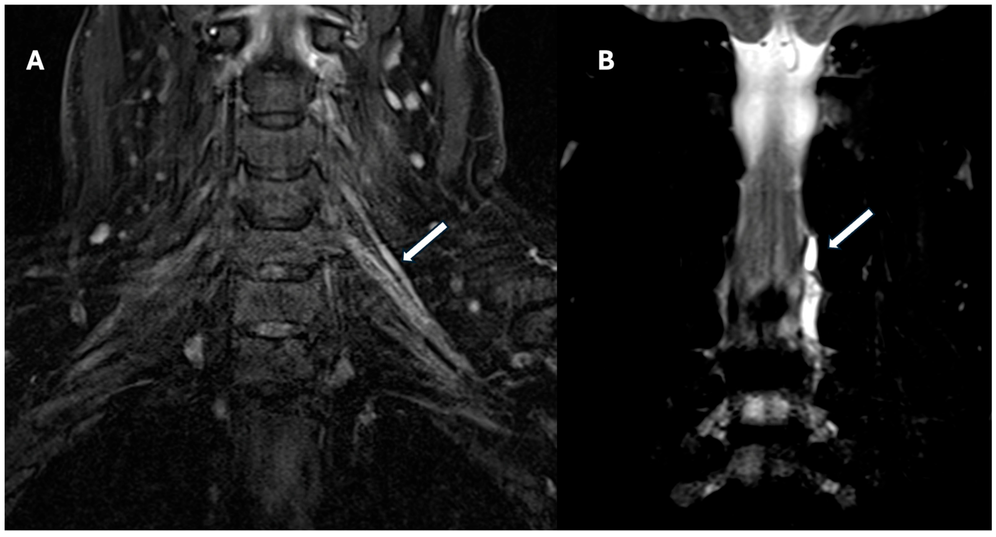 Jcm 14 06311 g003 Jcm 14 06311 g003