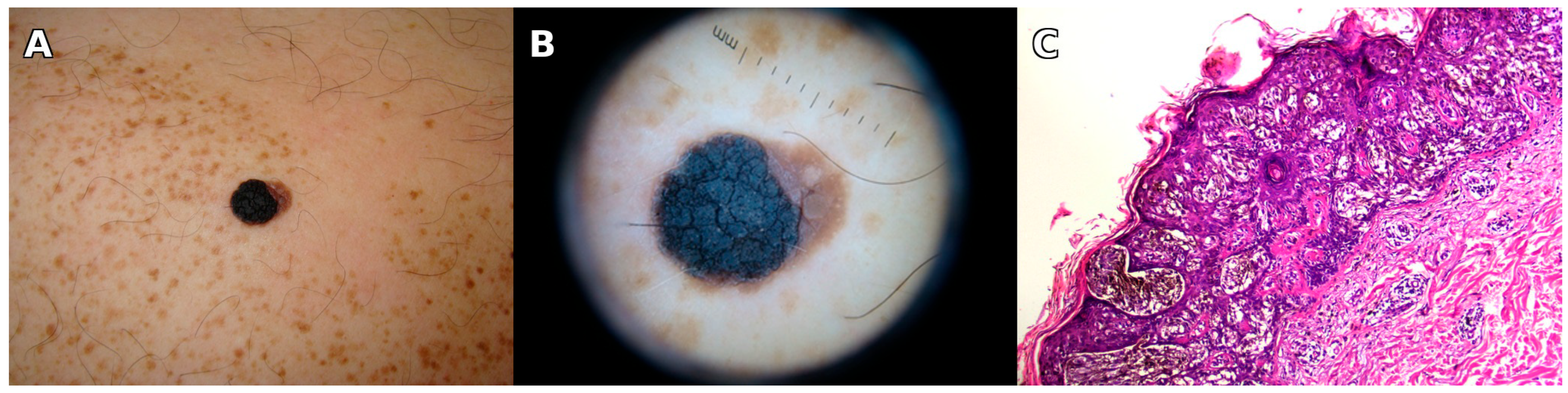 Jcm 14 06366 g001 Jcm 14 06366 g001