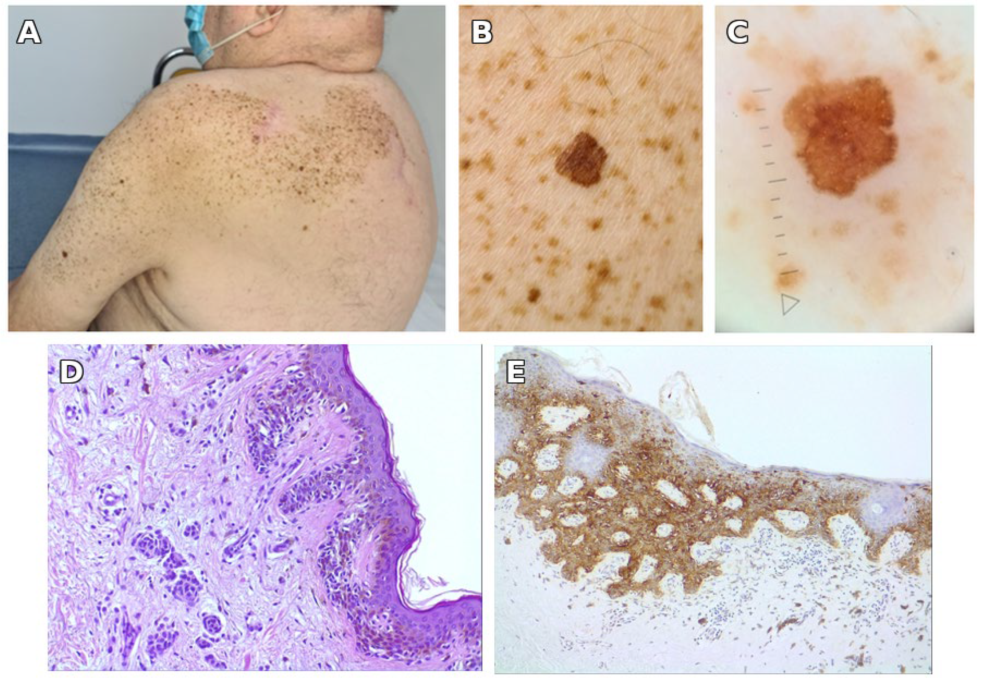 Jcm 14 06366 g002 Jcm 14 06366 g002