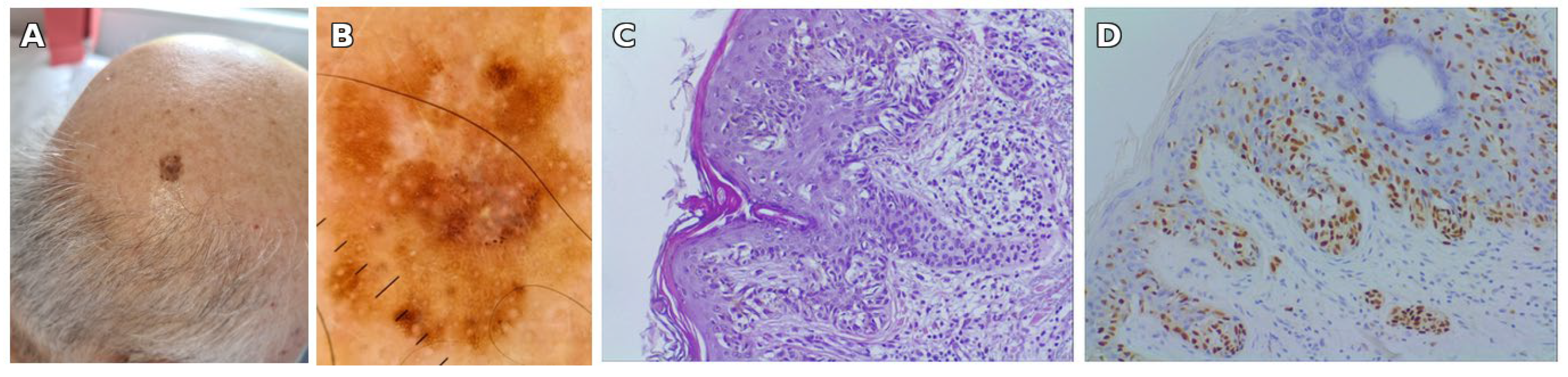 Jcm 14 06366 g003 Jcm 14 06366 g003