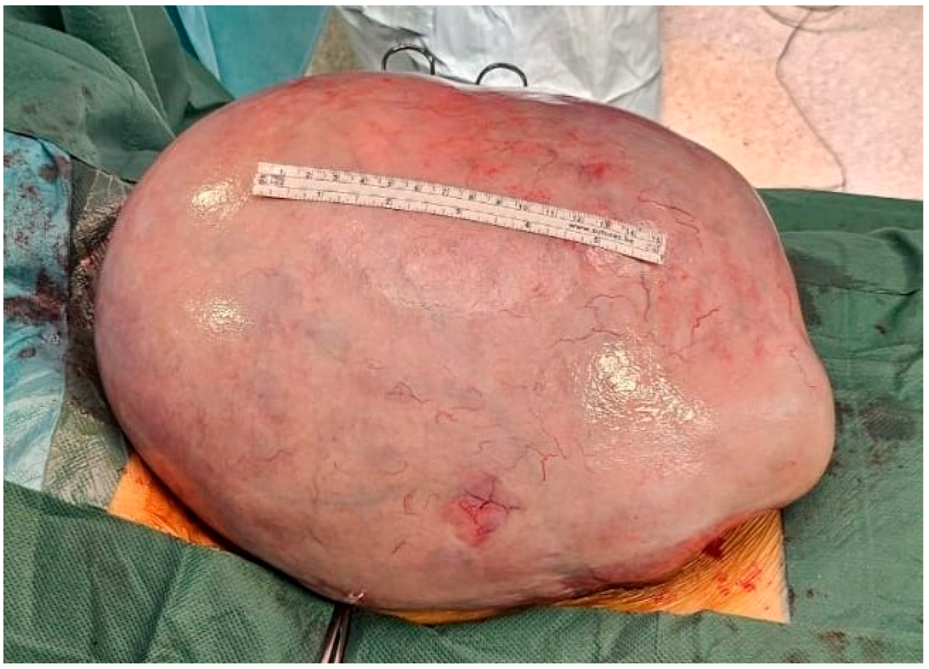 Jcm 14 06387 g003 Jcm 14 06387 g003