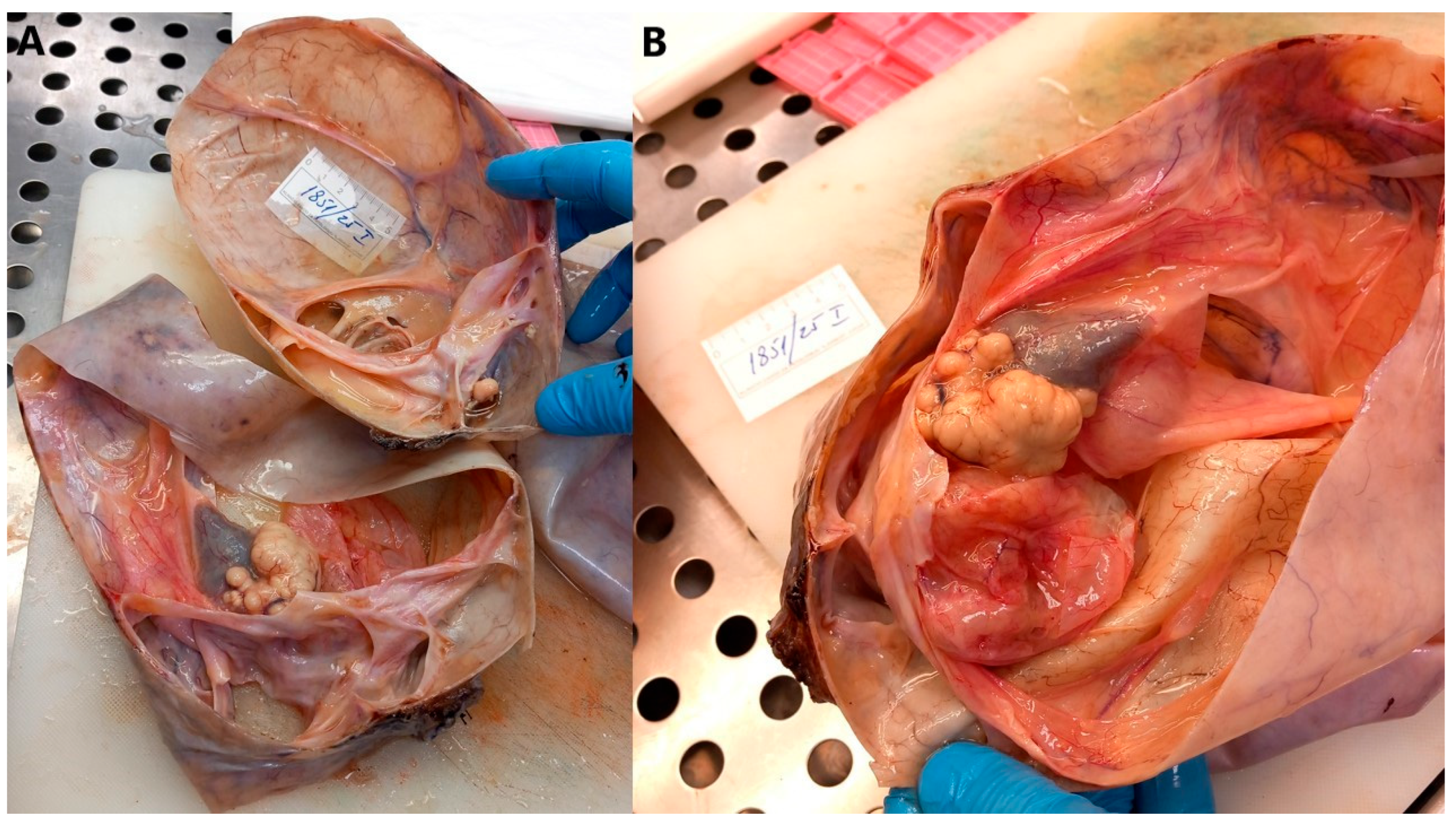 Jcm 14 06387 g004 Jcm 14 06387 g004