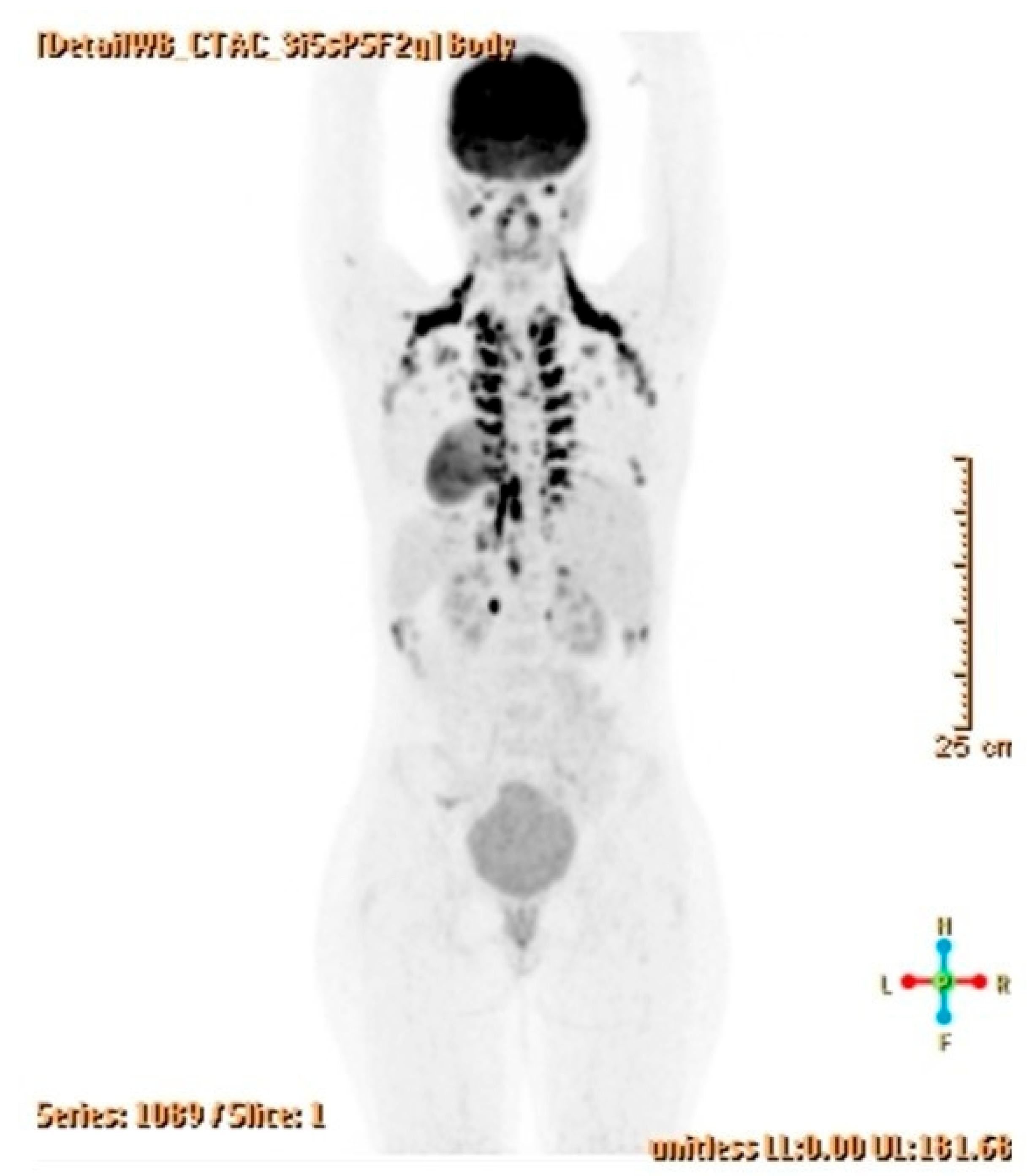 Jcm 14 06387 g008 Jcm 14 06387 g008