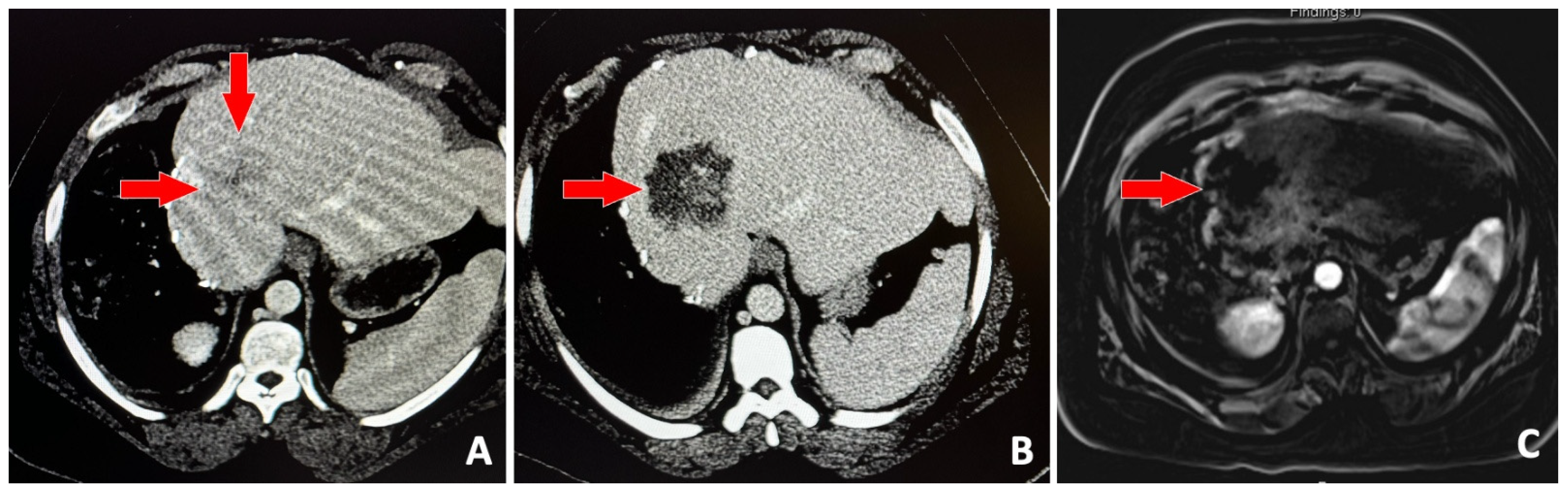 Jcm 14 06391 g002 Jcm 14 06391 g002