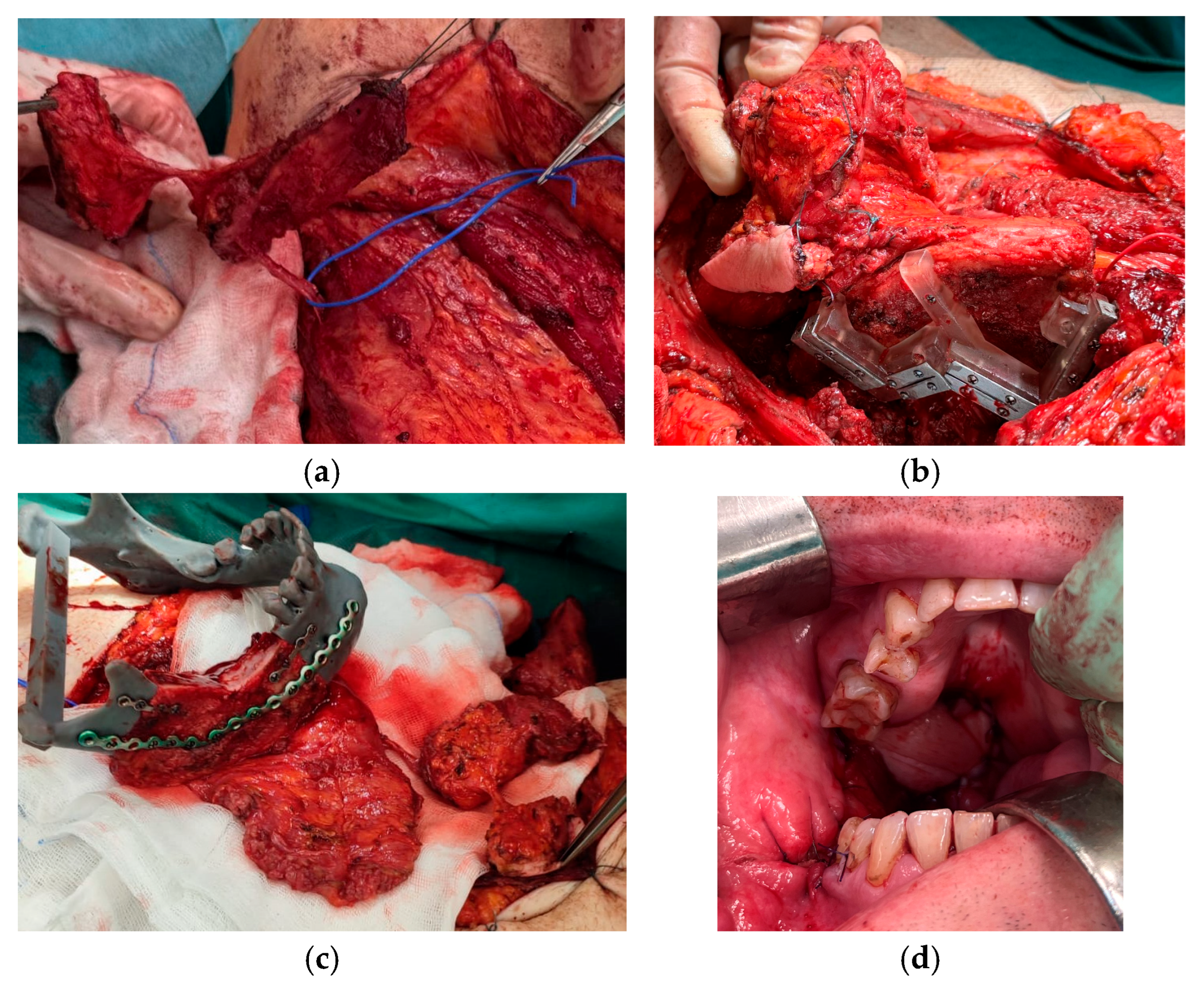 Jcm 14 06405 g003 Jcm 14 06405 g003