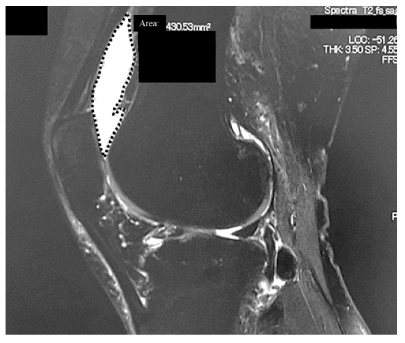 Jcm 14 06408 g001 Jcm 14 06408 g001