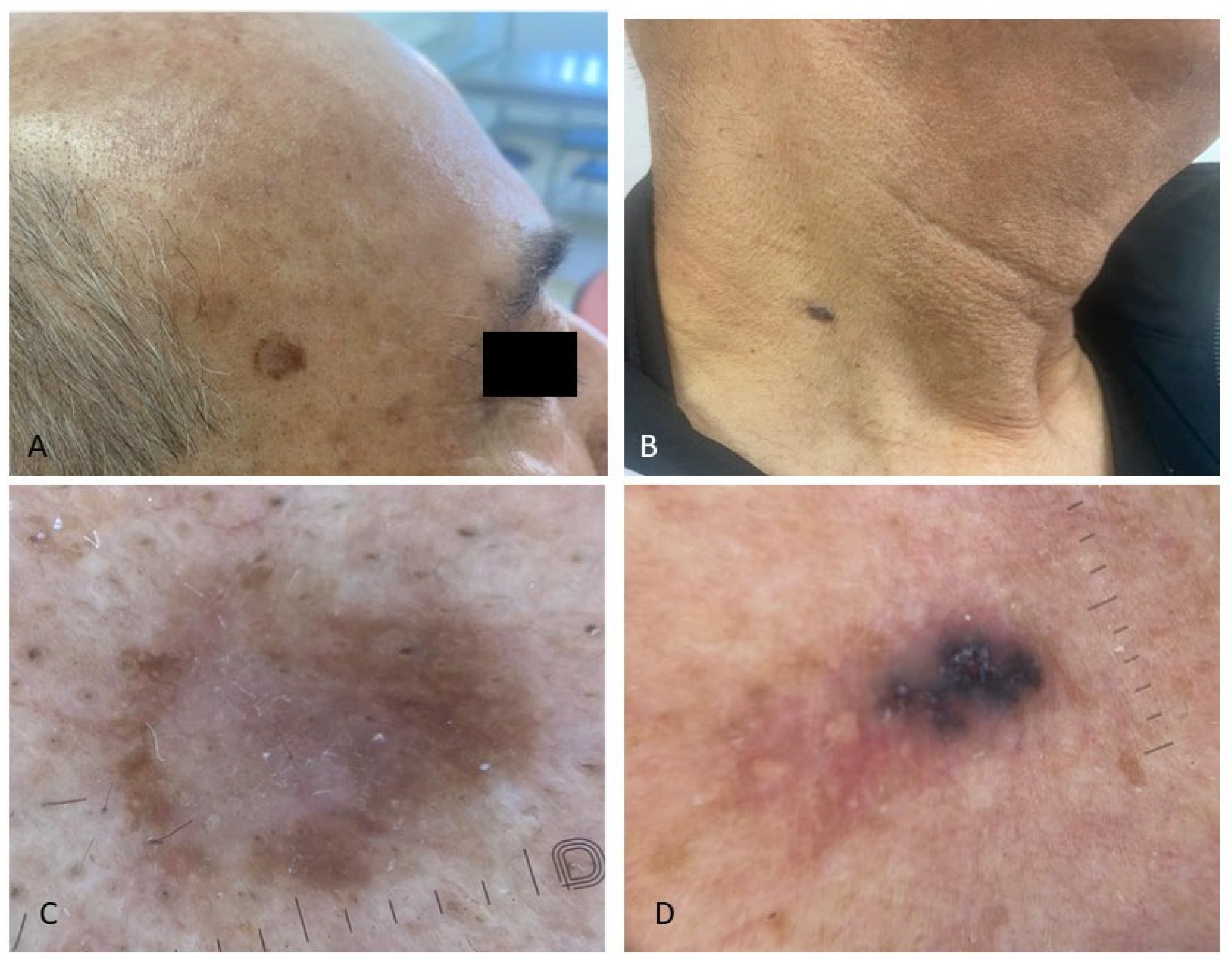 Jcm 14 06447 g002 Jcm 14 06447 g002