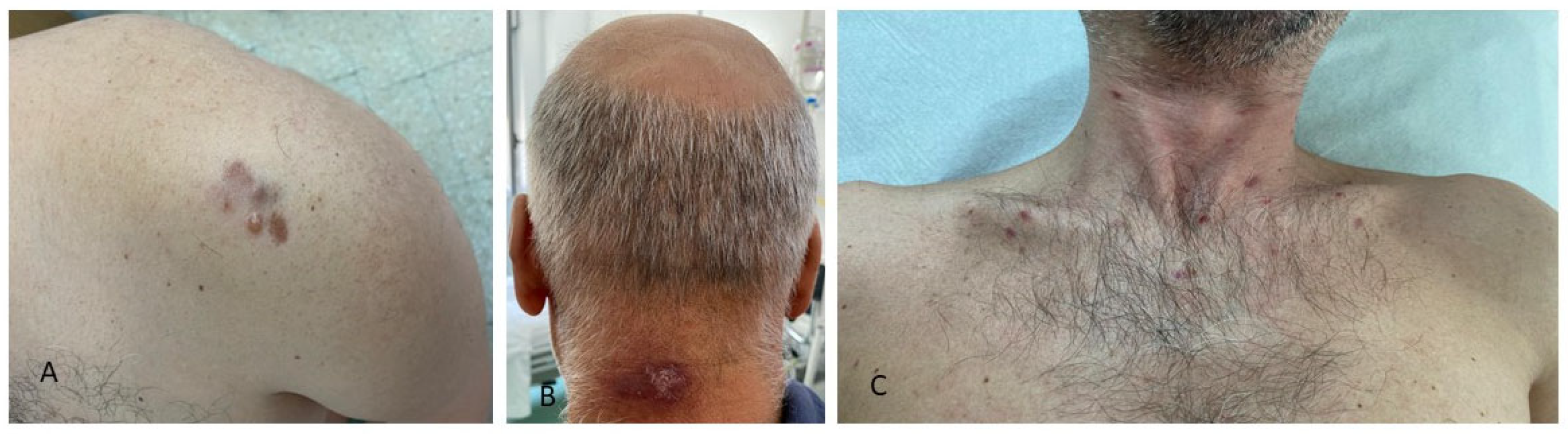 Jcm 14 06447 g003 Jcm 14 06447 g003