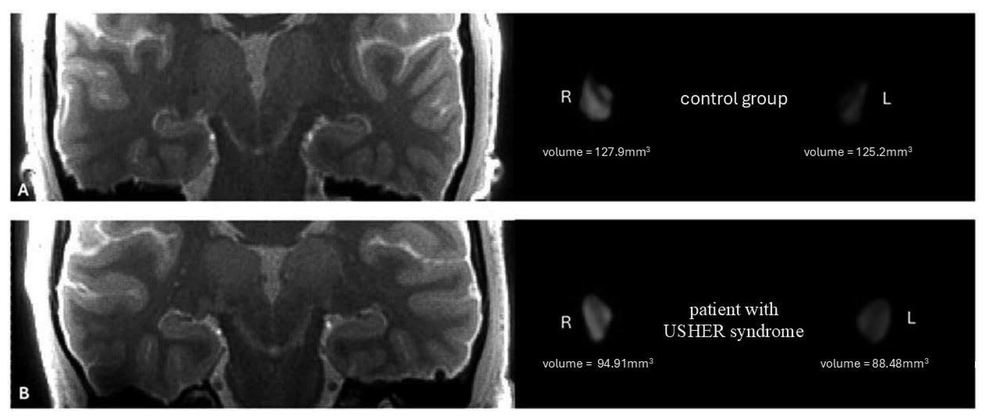 Jcm 14 06493 g003 Jcm 14 06493 g003