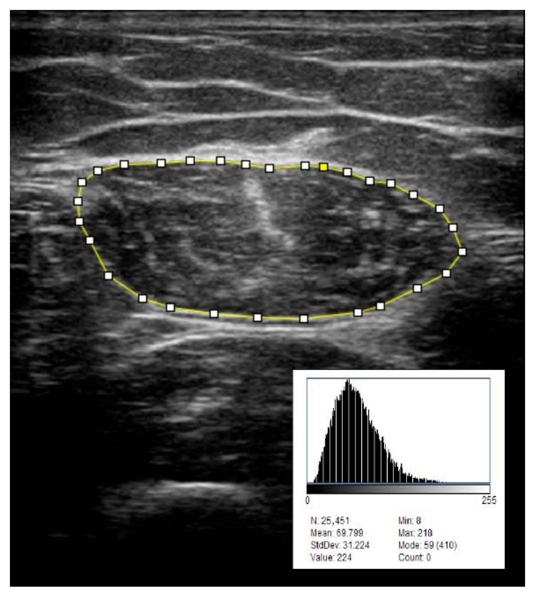 Jcm 14 06531 g001 Jcm 14 06531 g001