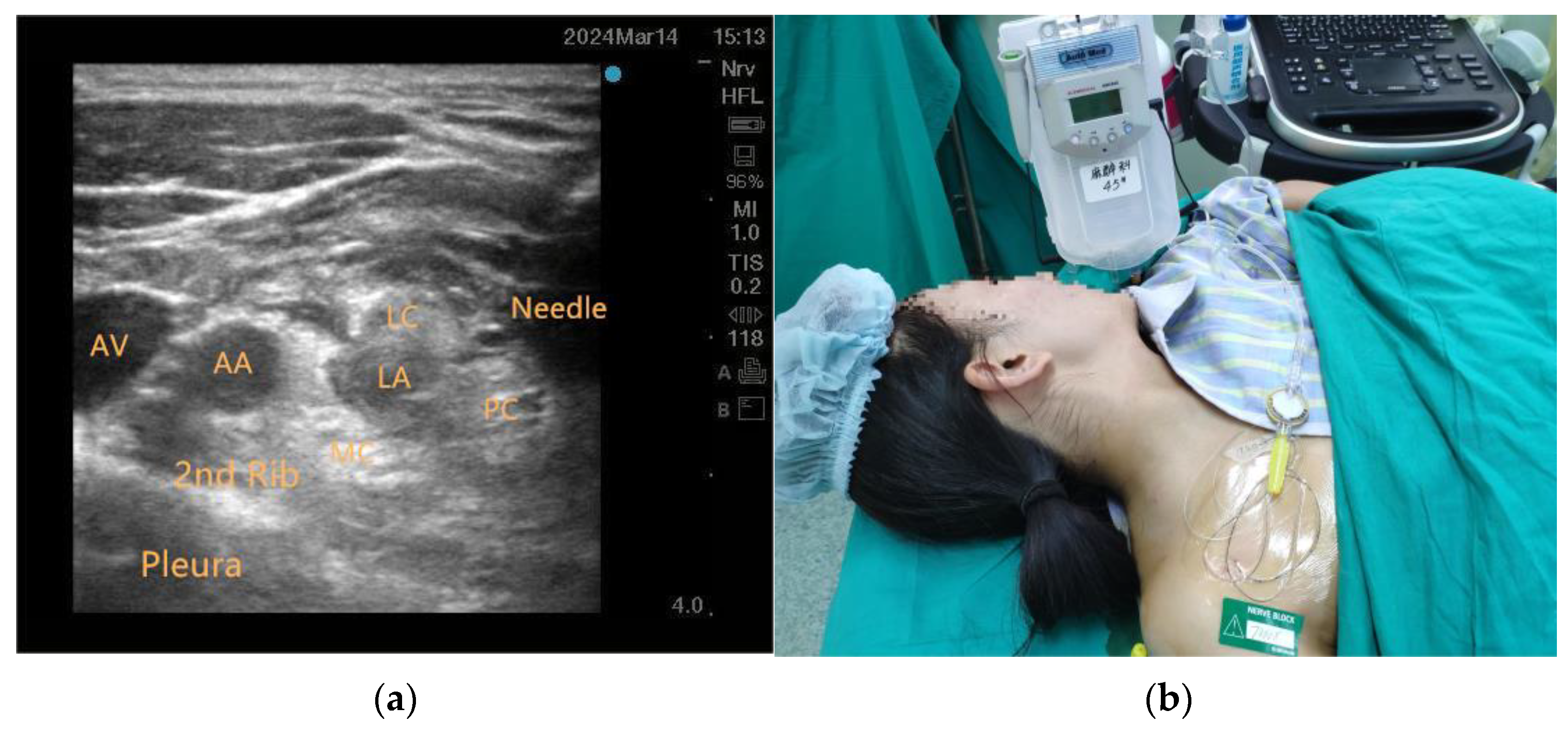 Jcm 14 06591 g001 Jcm 14 06591 g001